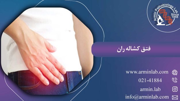 فتق کشاله ران