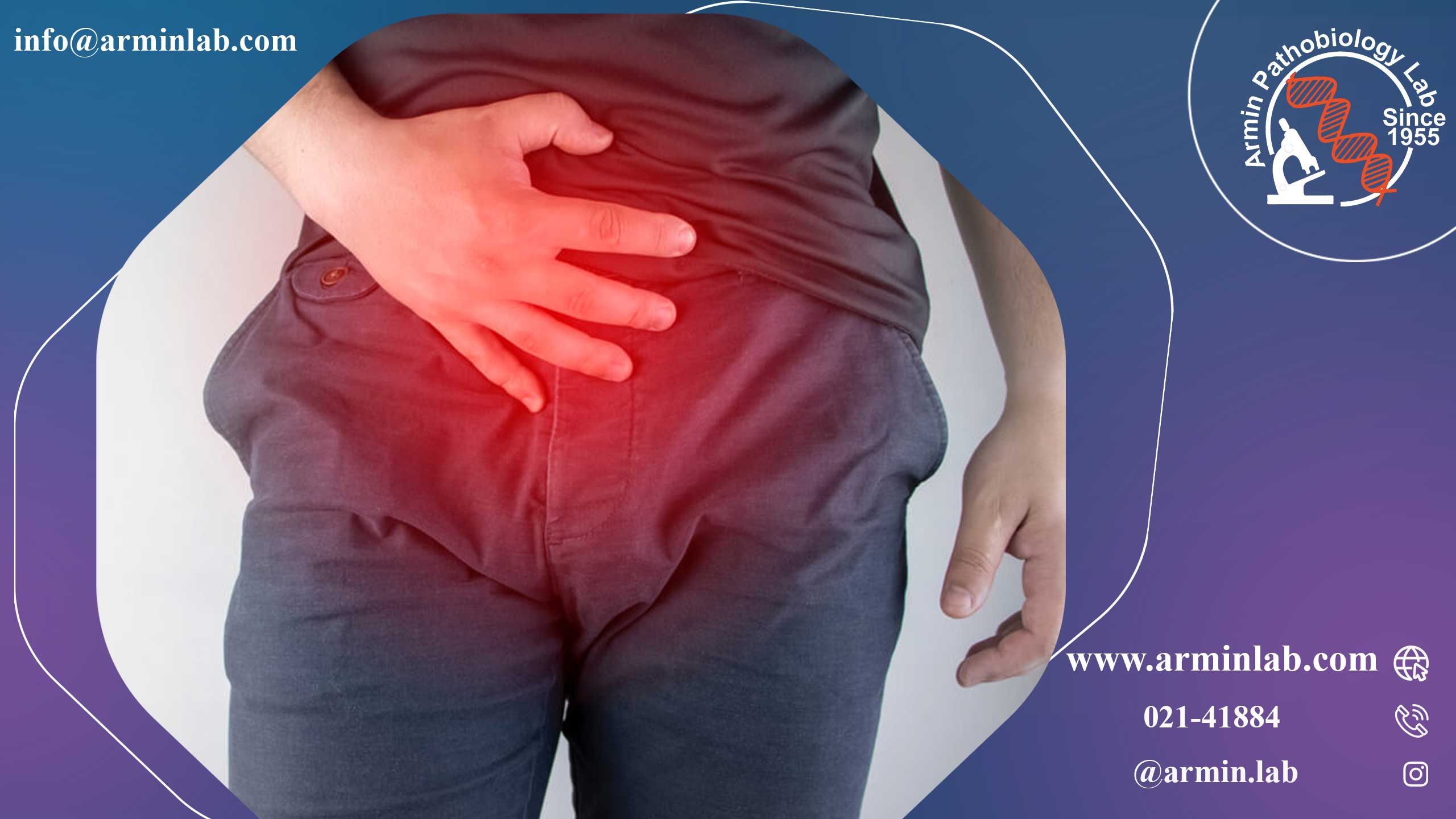 فتق کشاله ران