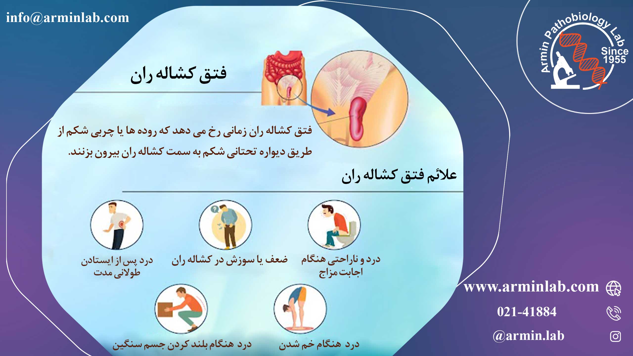 فتق کشاله ران