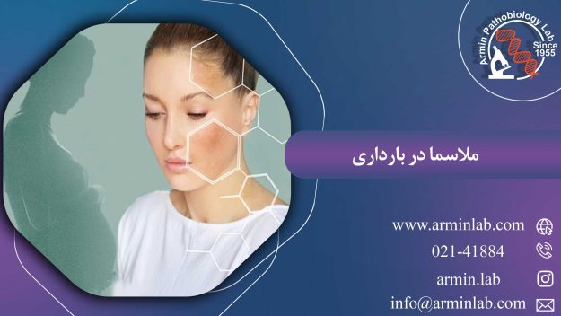 ملاسما در بارداری