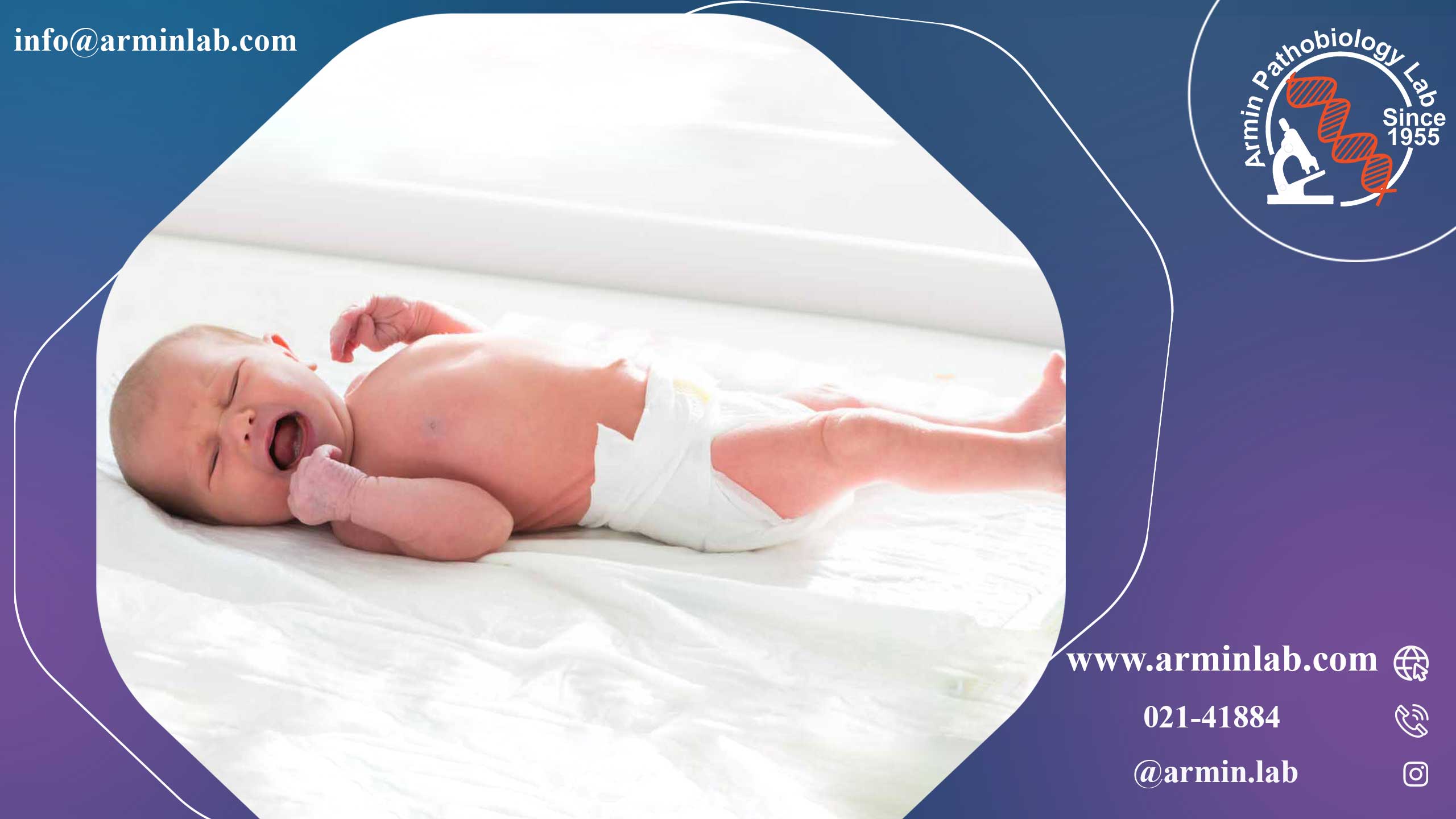 هایپرکپلکسی ارثی (HPX)