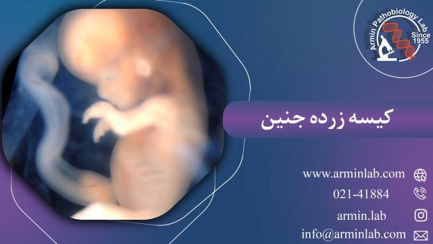 کیسه زرده جنین