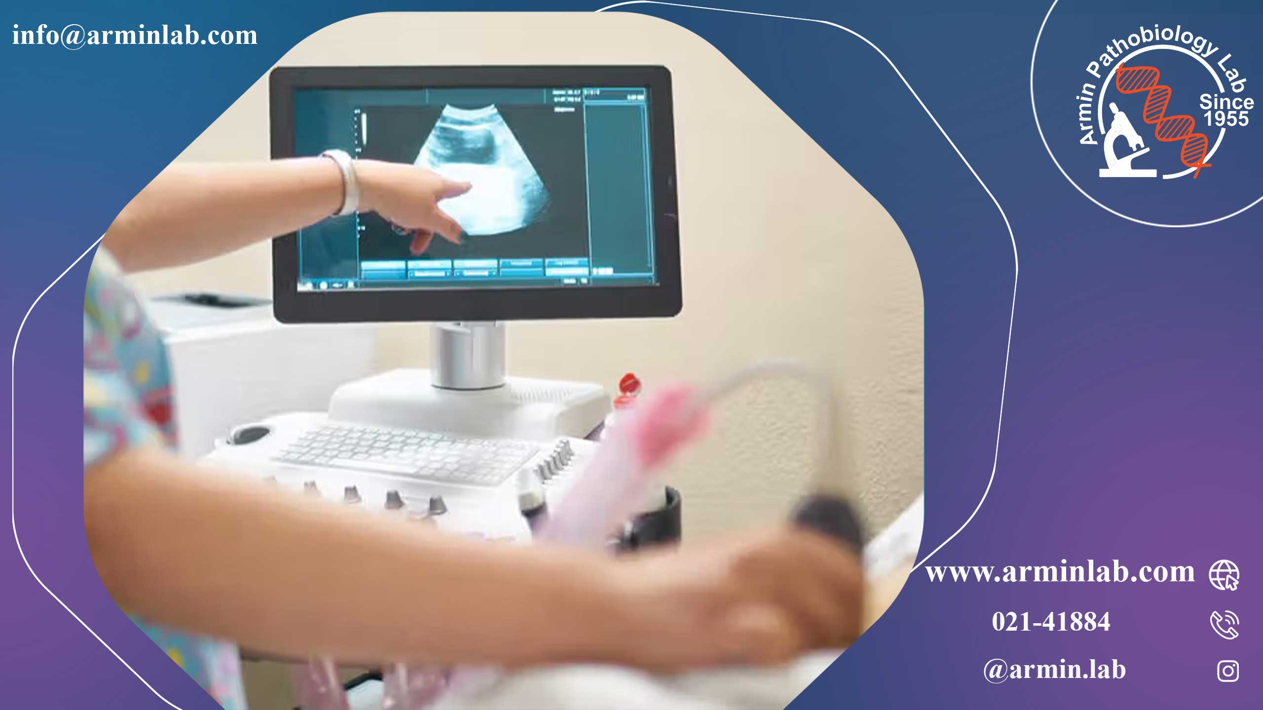 کیسه زرده جنین