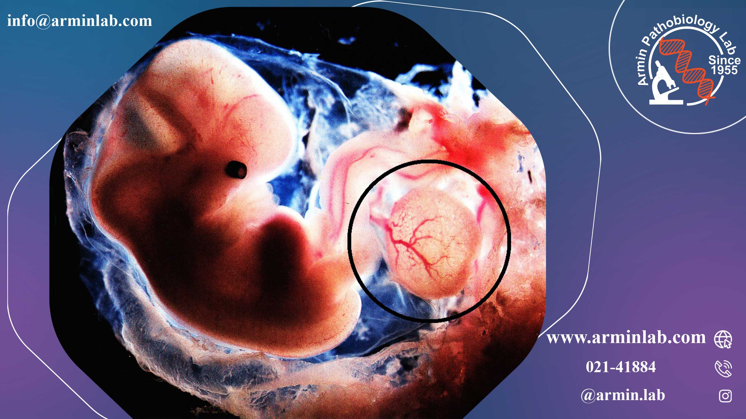 کیسه زرده جنین