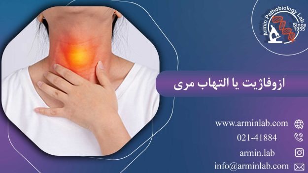 ازوفاژیت یا التهاب مری