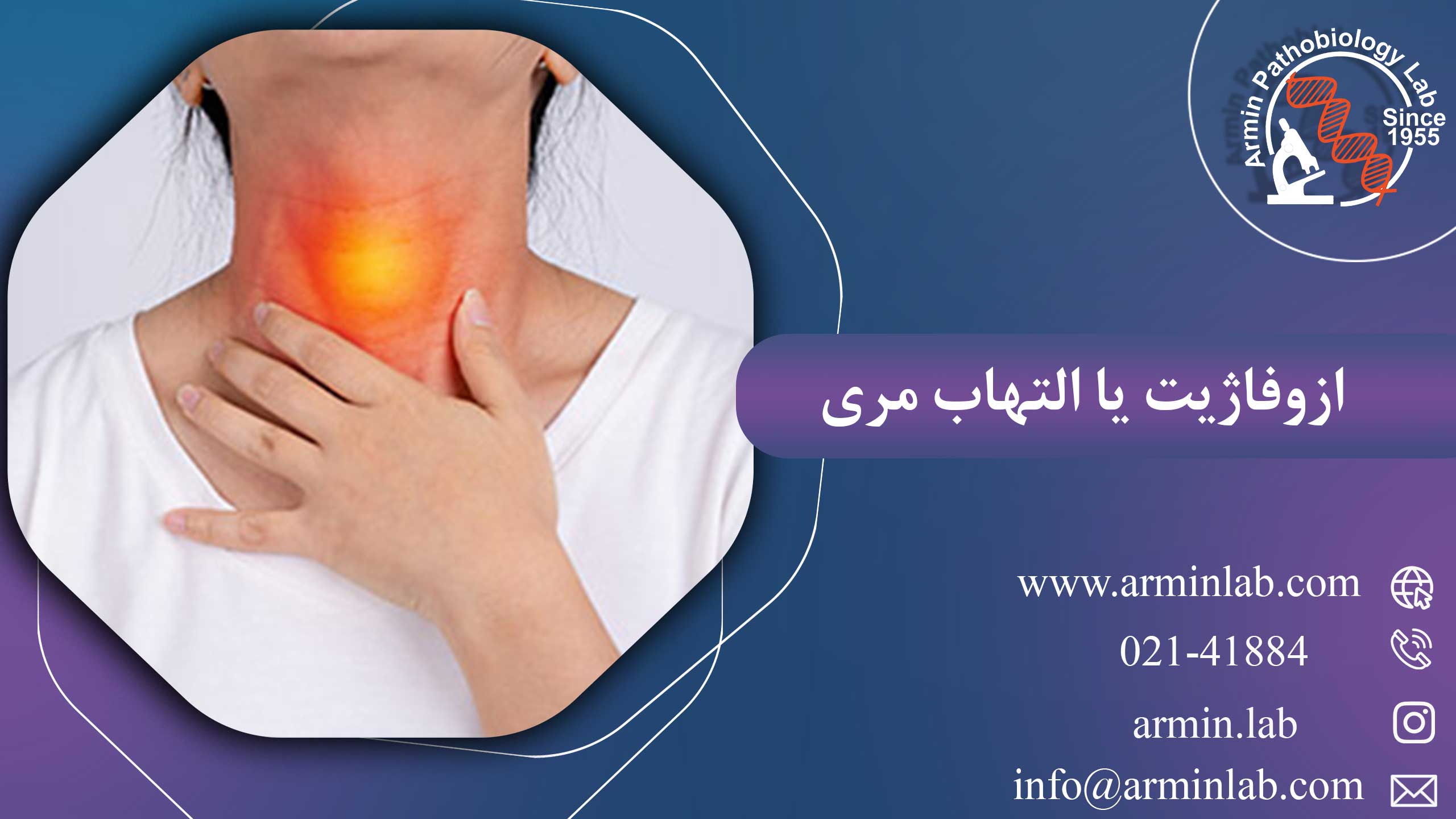 ازوفاژیت یا التهاب مری