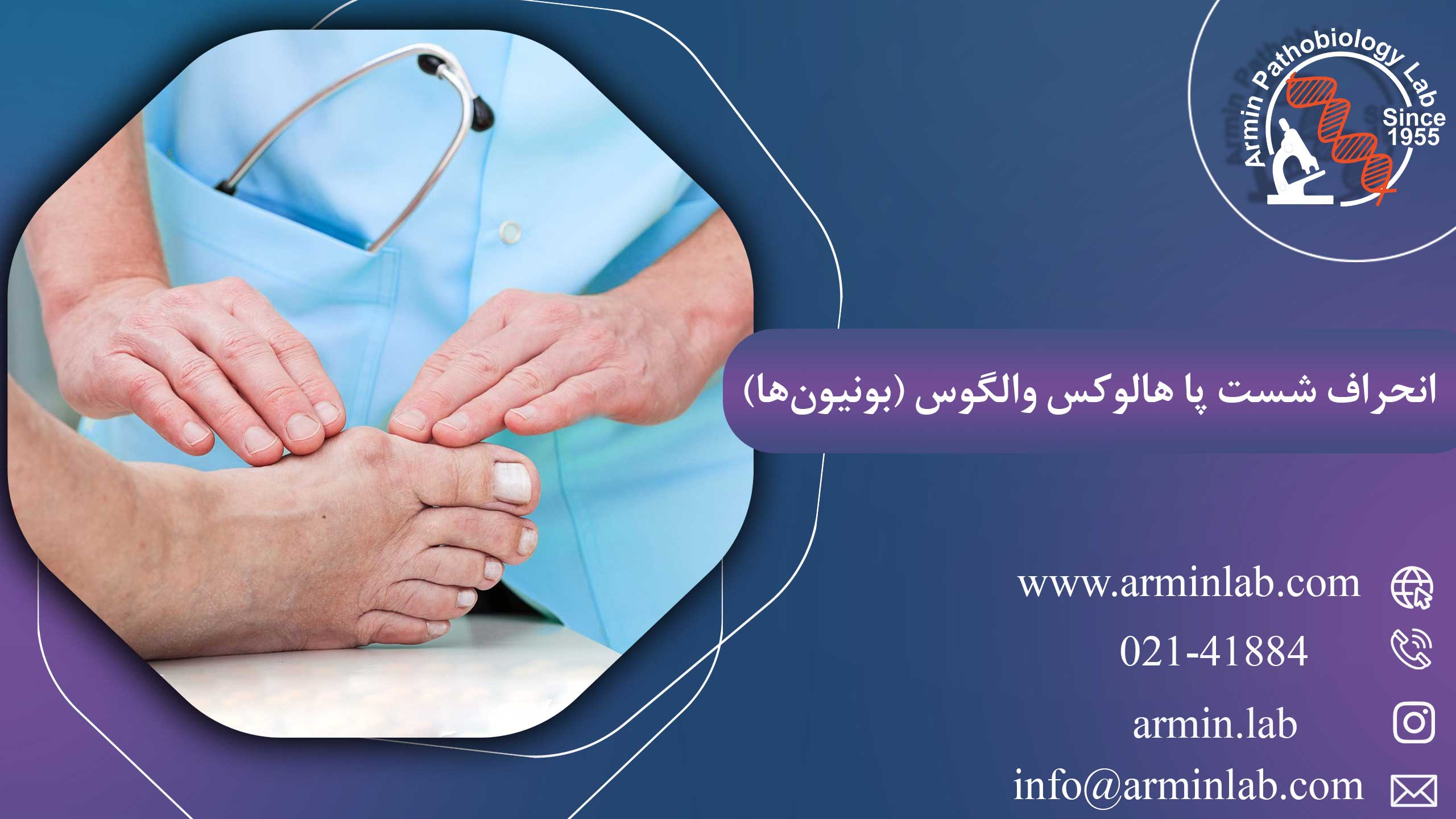 انحراف شست پا هالوکس والگوس (بونیون‌ها)