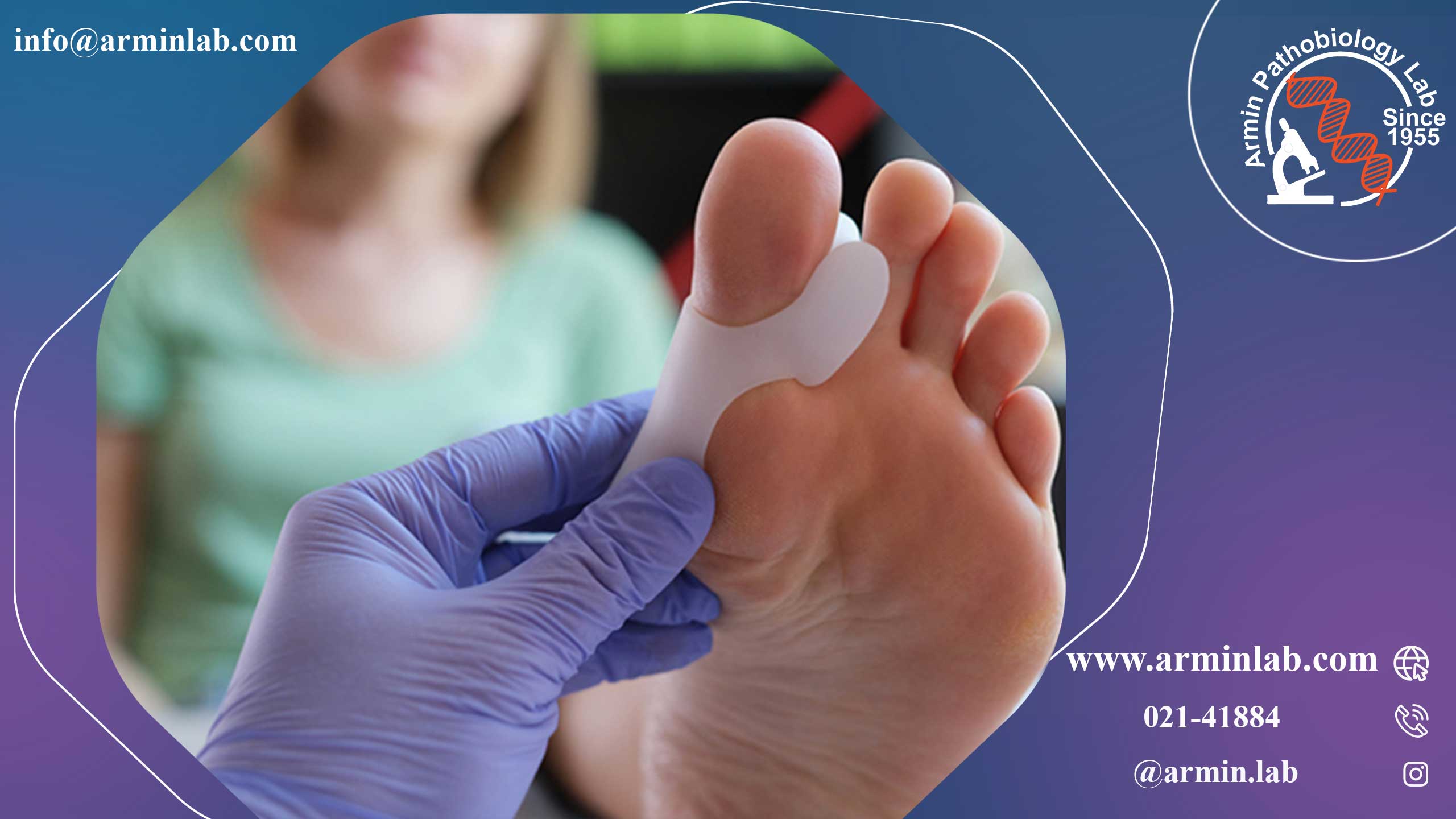 انحراف شست پا هالوکس والگوس (بونیون‌ها)