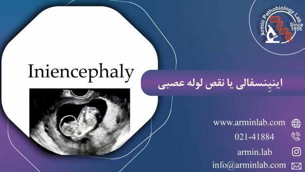 اینیِنسفالی یا نقص لوله عصبی