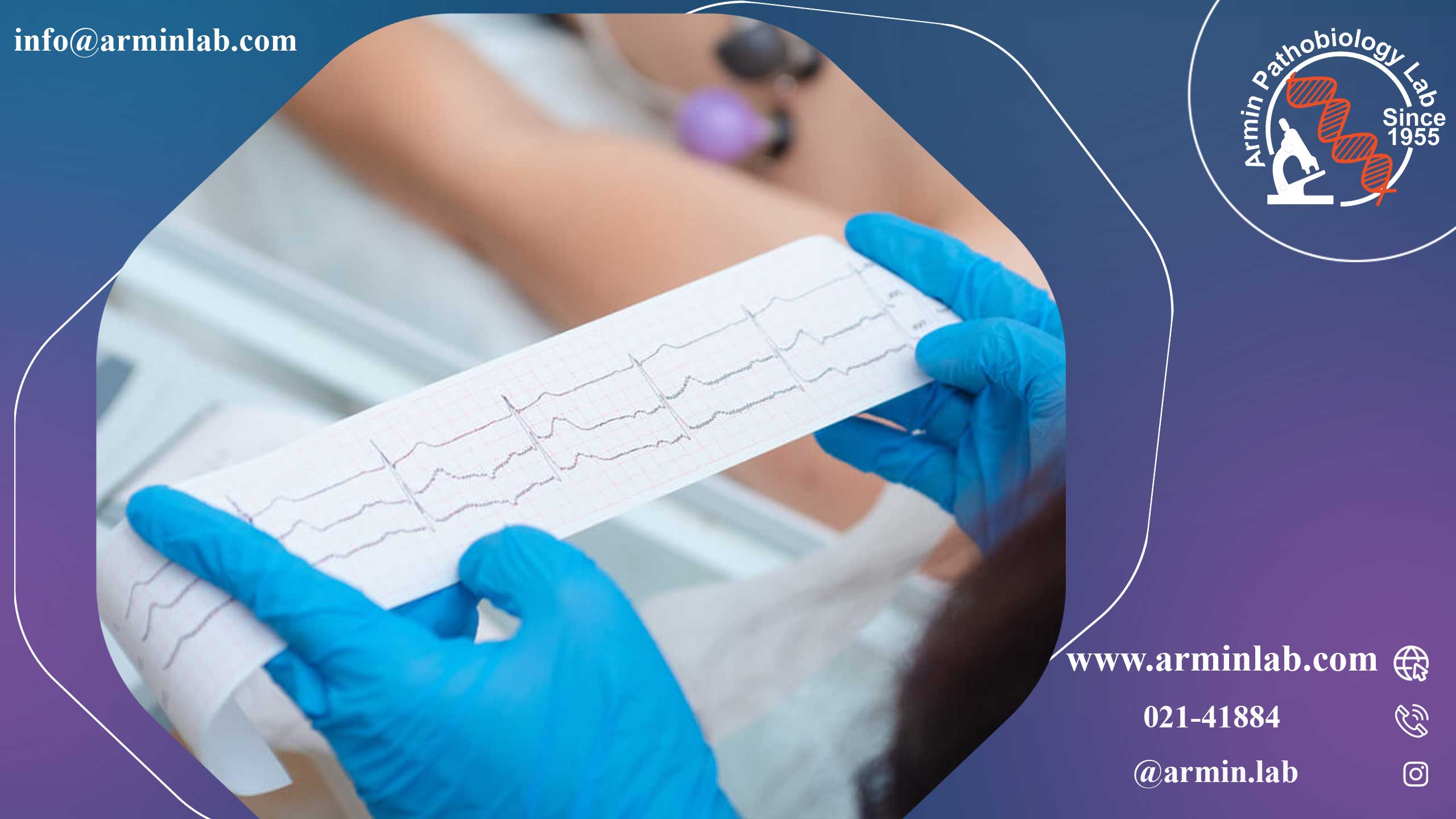 برادی کاردی (ضربان قلب آهسته)