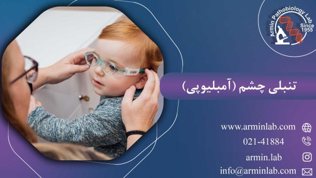 تنبلی چشم (آمبلیوپی)