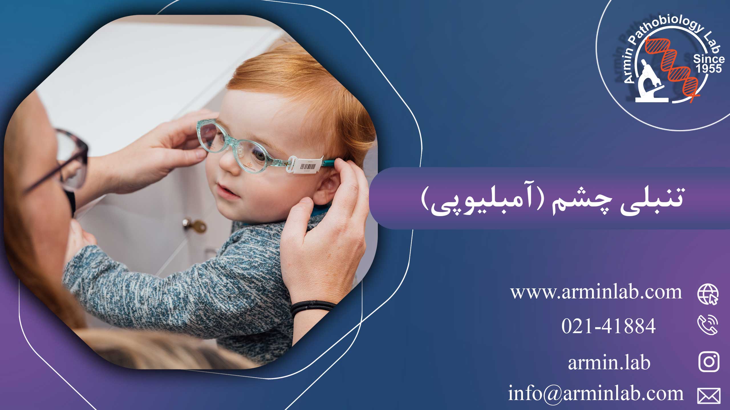 تنبلی چشم (آمبلیوپی)