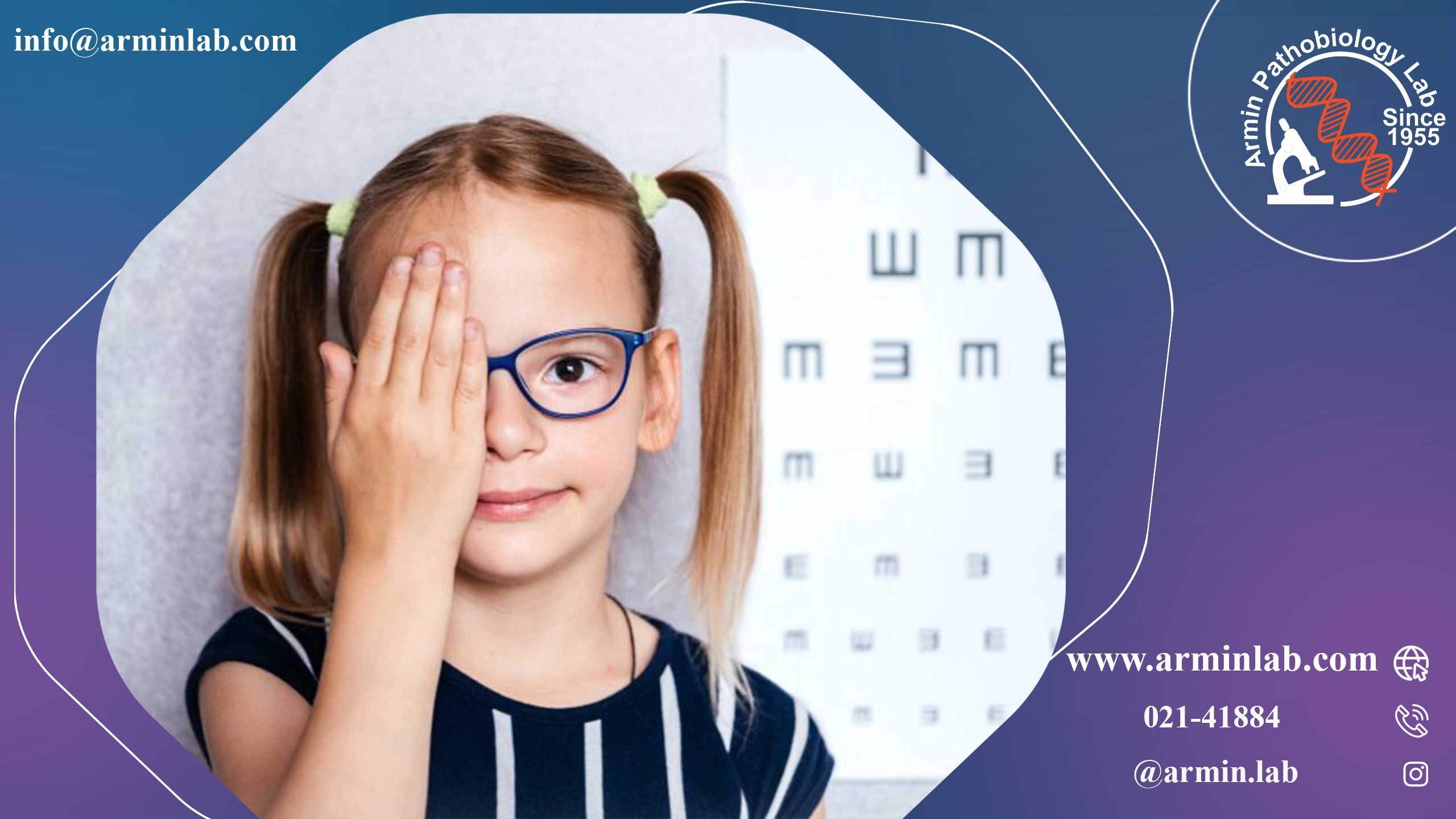 تنبلی چشم (آمبلیوپی)