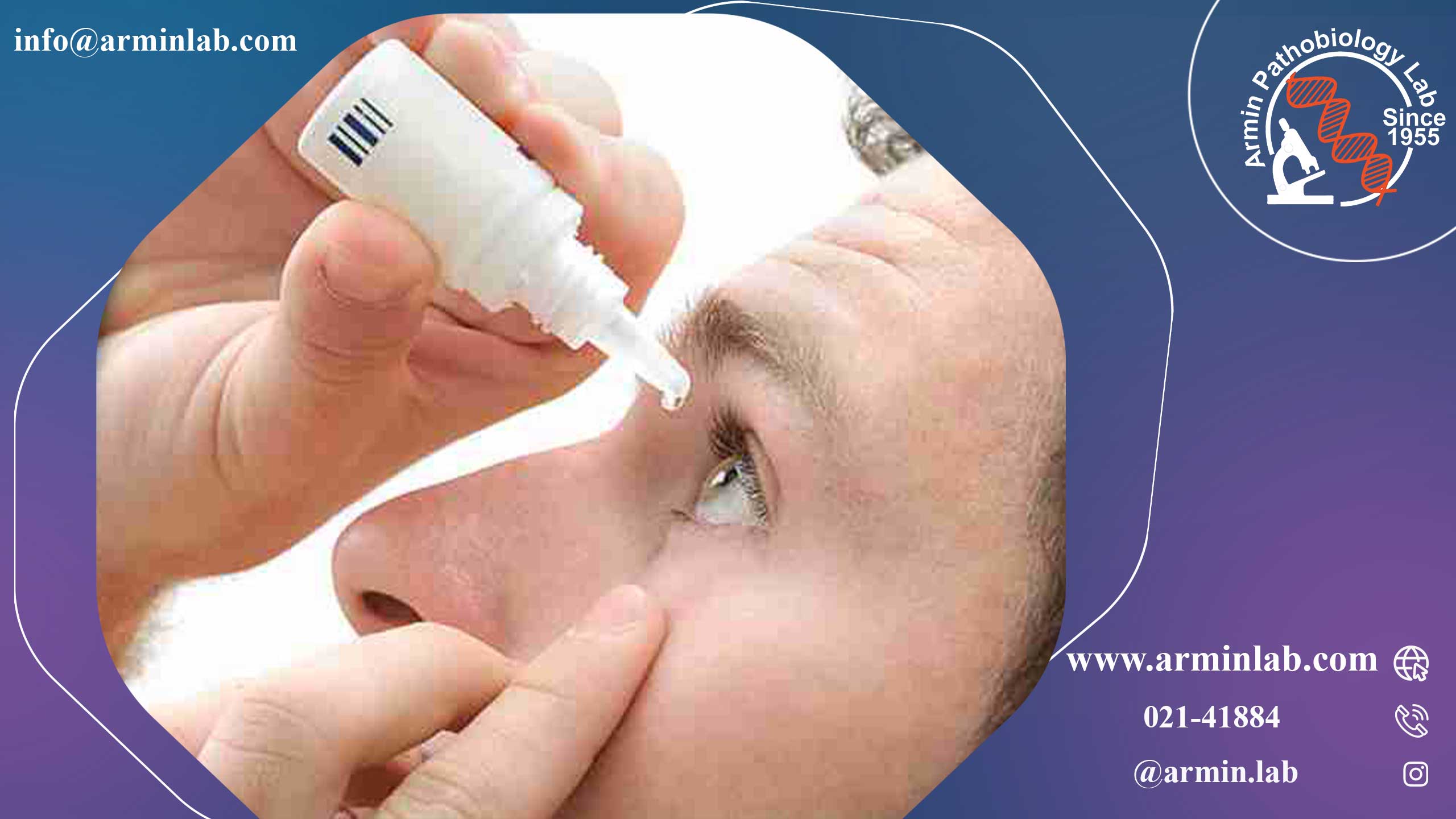 تنبلی چشم (آمبلیوپی)