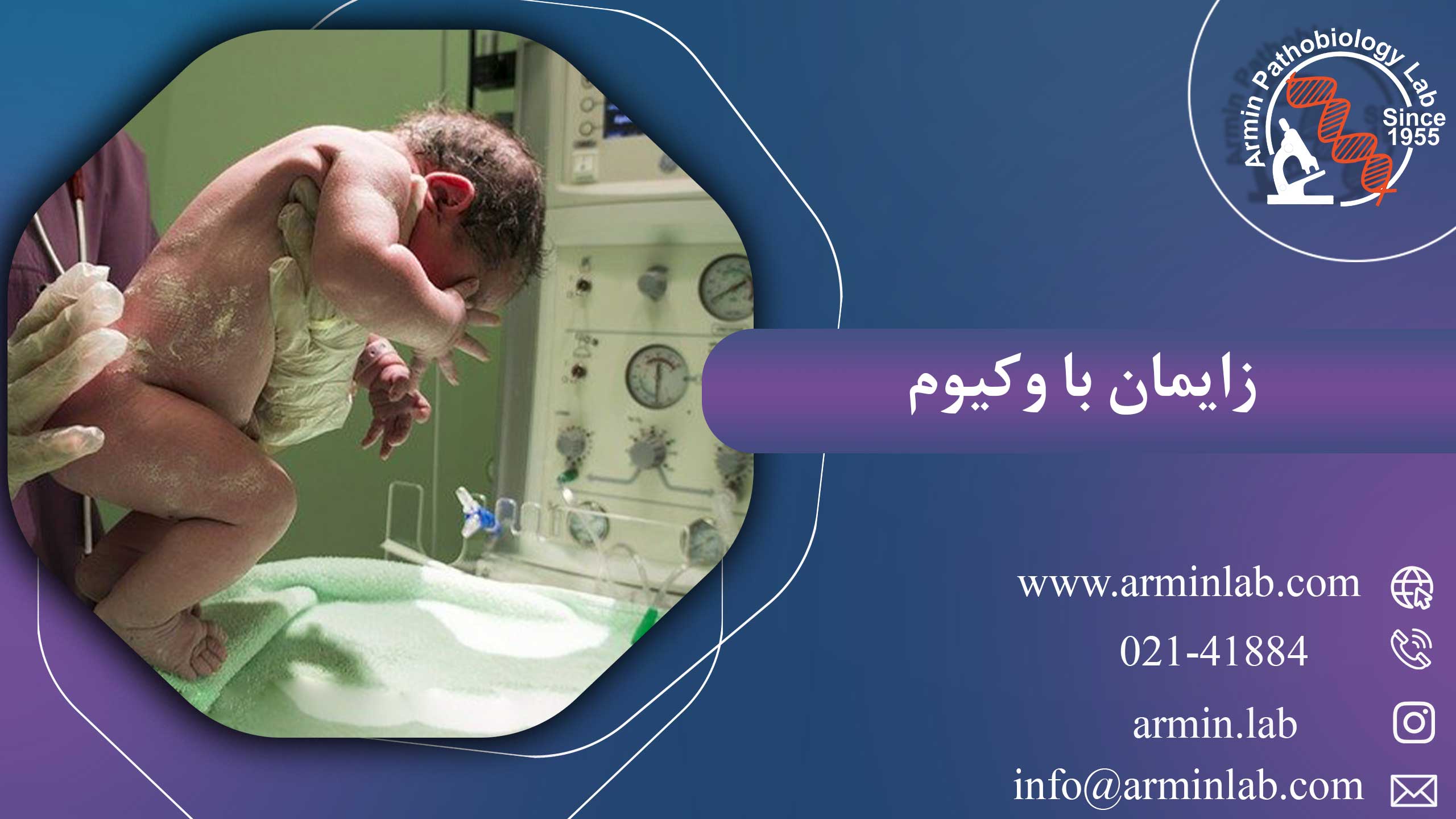 زایمان با وکیوم