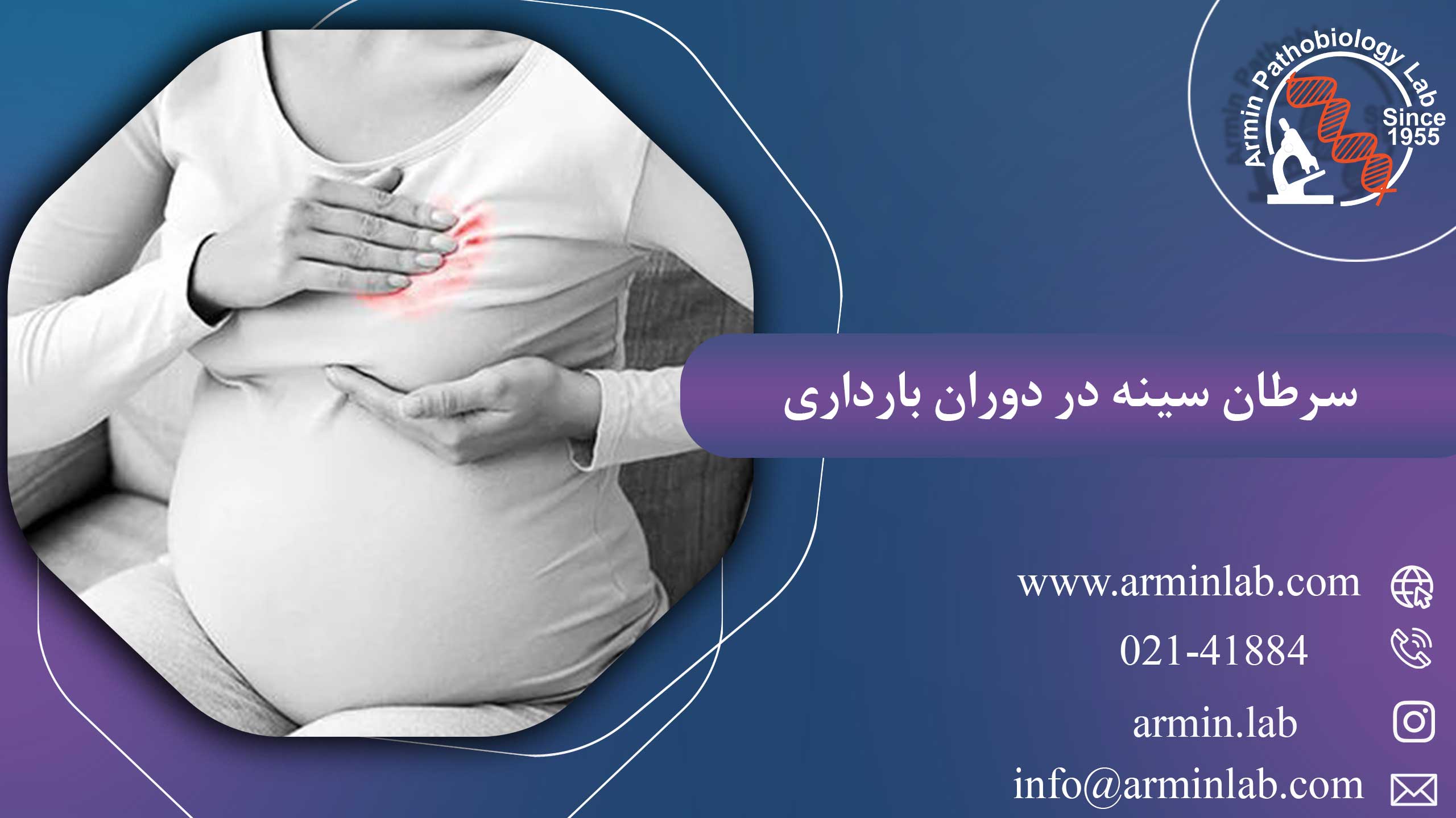 سرطان سینه در دوران بارداری