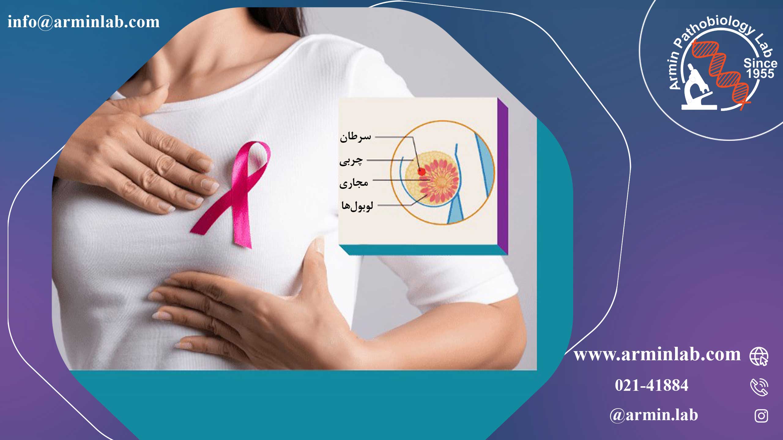 سرطان سینه در دوران بارداری