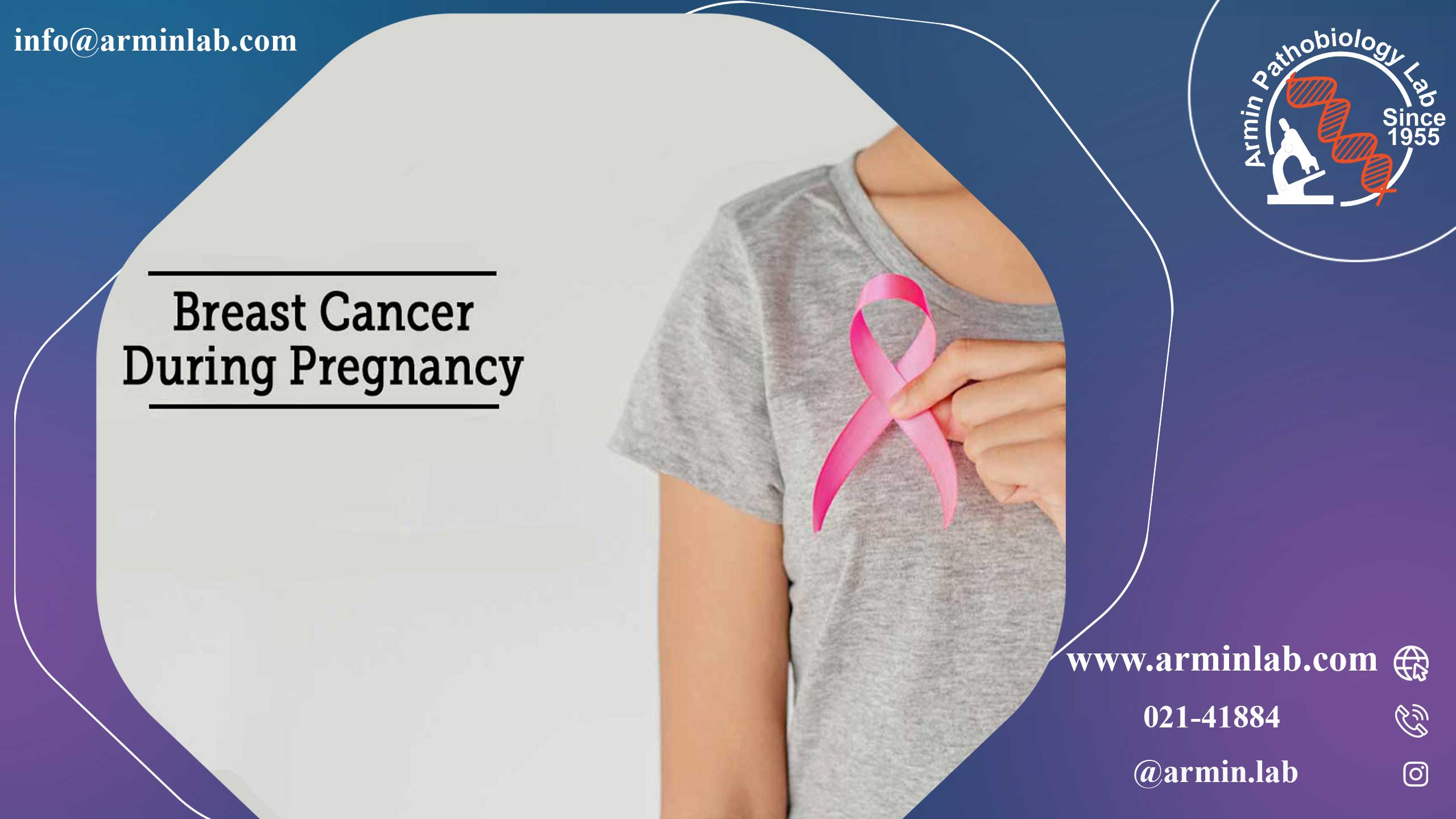 سرطان سینه در دوران بارداری