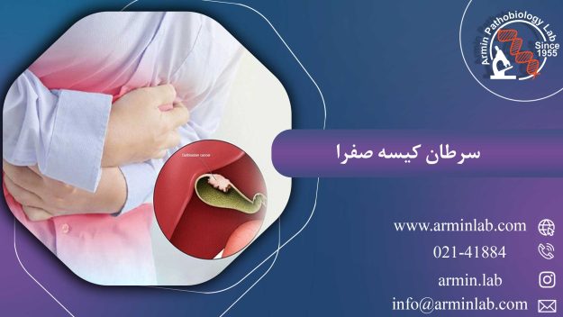 سرطان کیسه صفرا