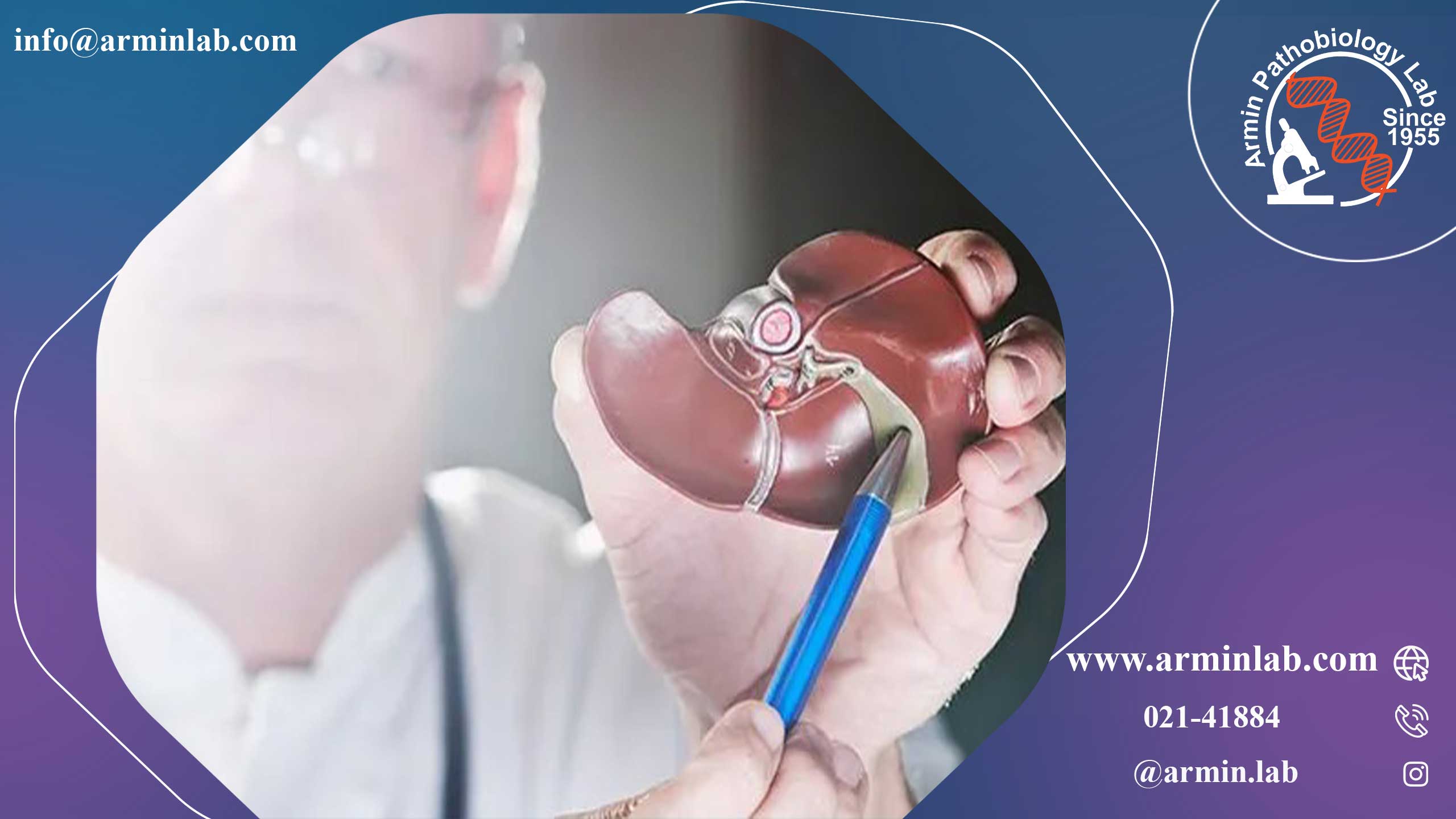 سرطان کیسه صفرا