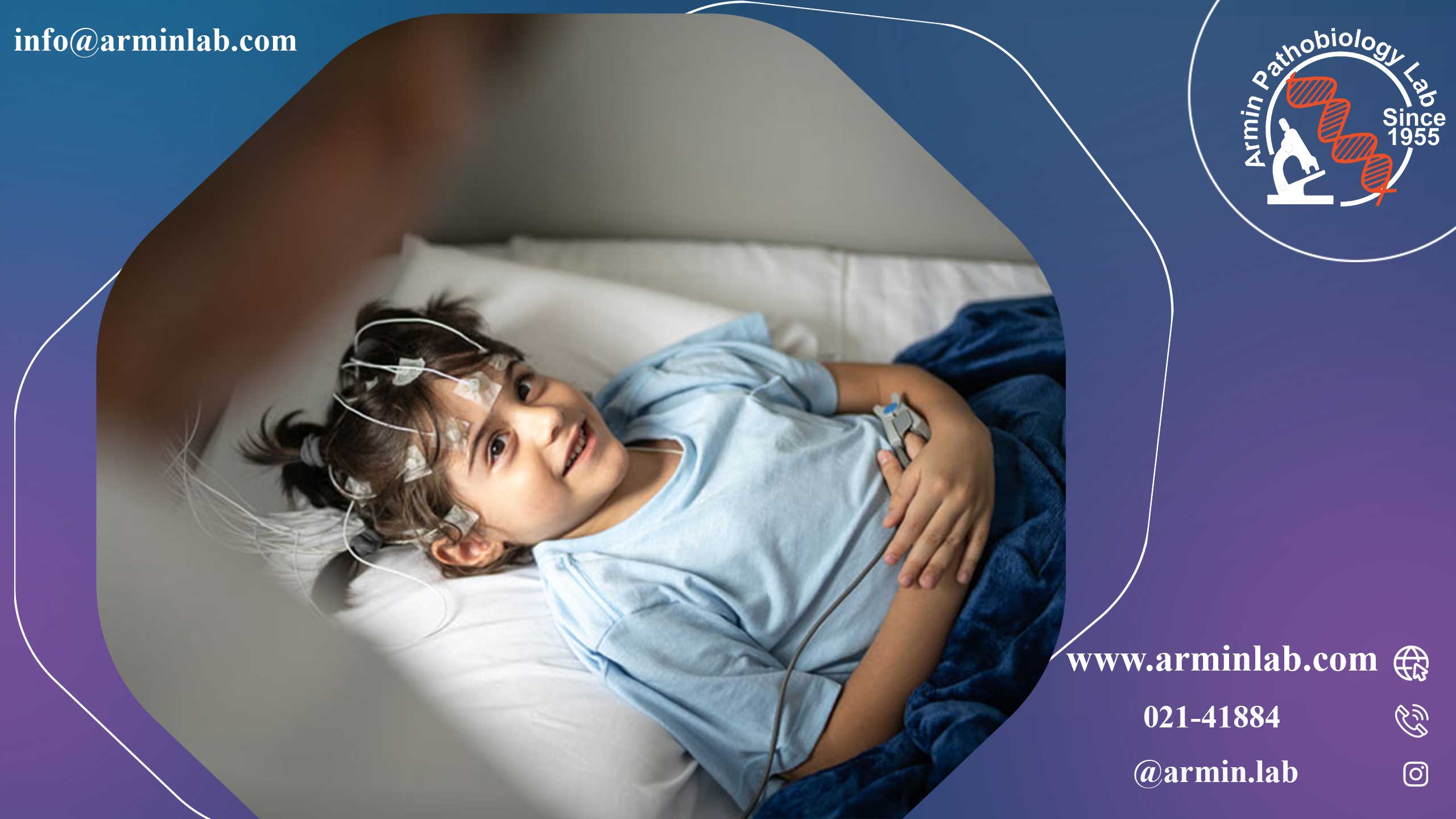 نارکولپسی در کودکان