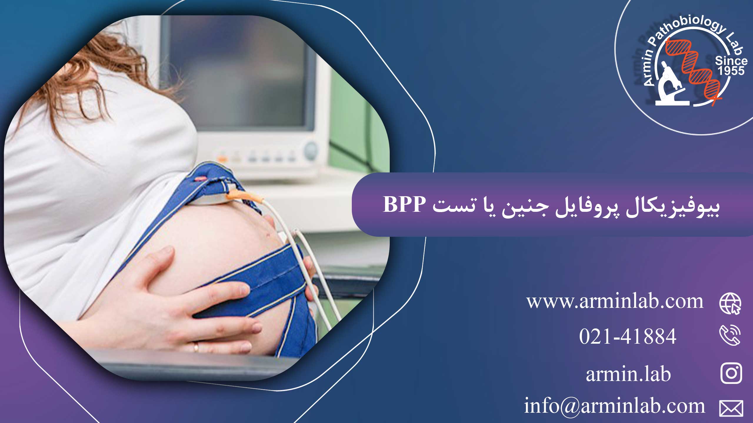 بیوفیزیکال پروفایل جنین یا تست BPP