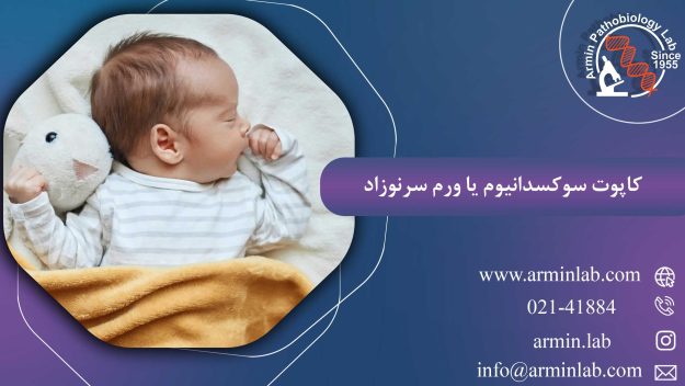 کاپوت سوکسدانیوم یا ورم سرنوزاد