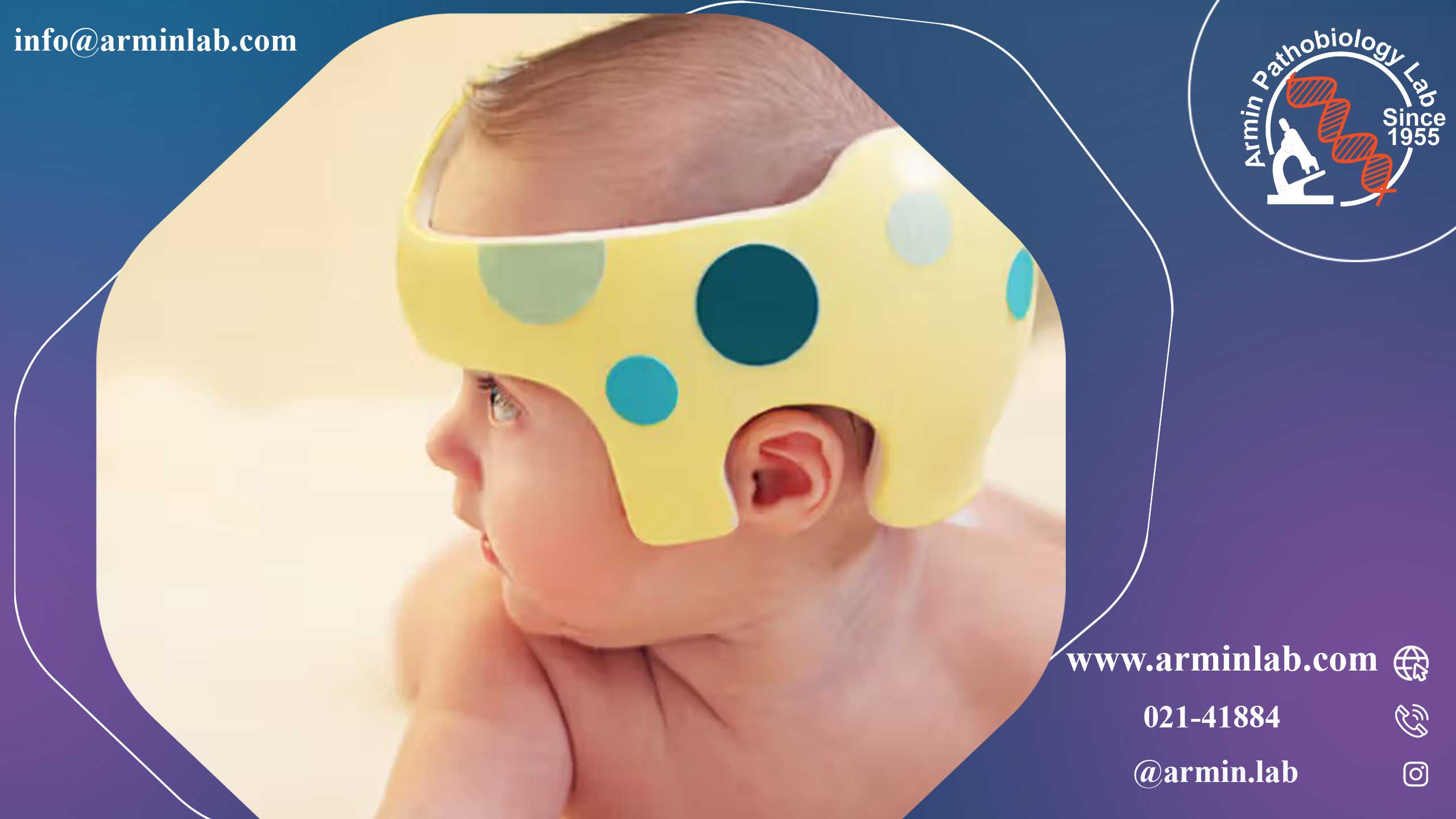 کاپوت سوکسدانیوم یا ورم سرنوزاد