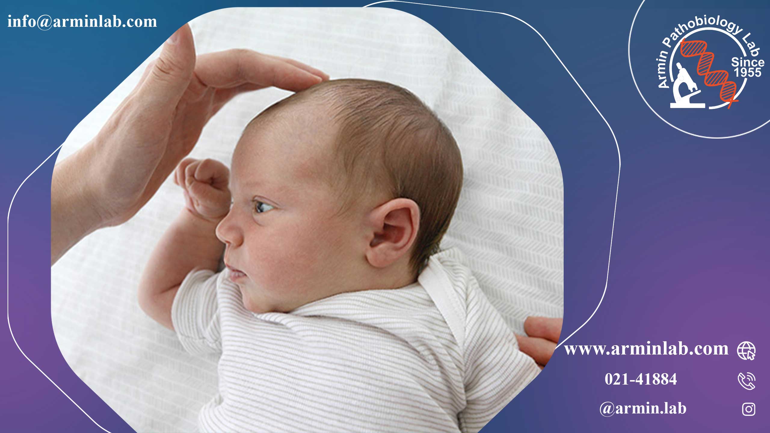 ملاج یا نقاط نرم سر نوزاد | آزمایشگاه آرمین | آمنیوسنتز | آزمایش خون
