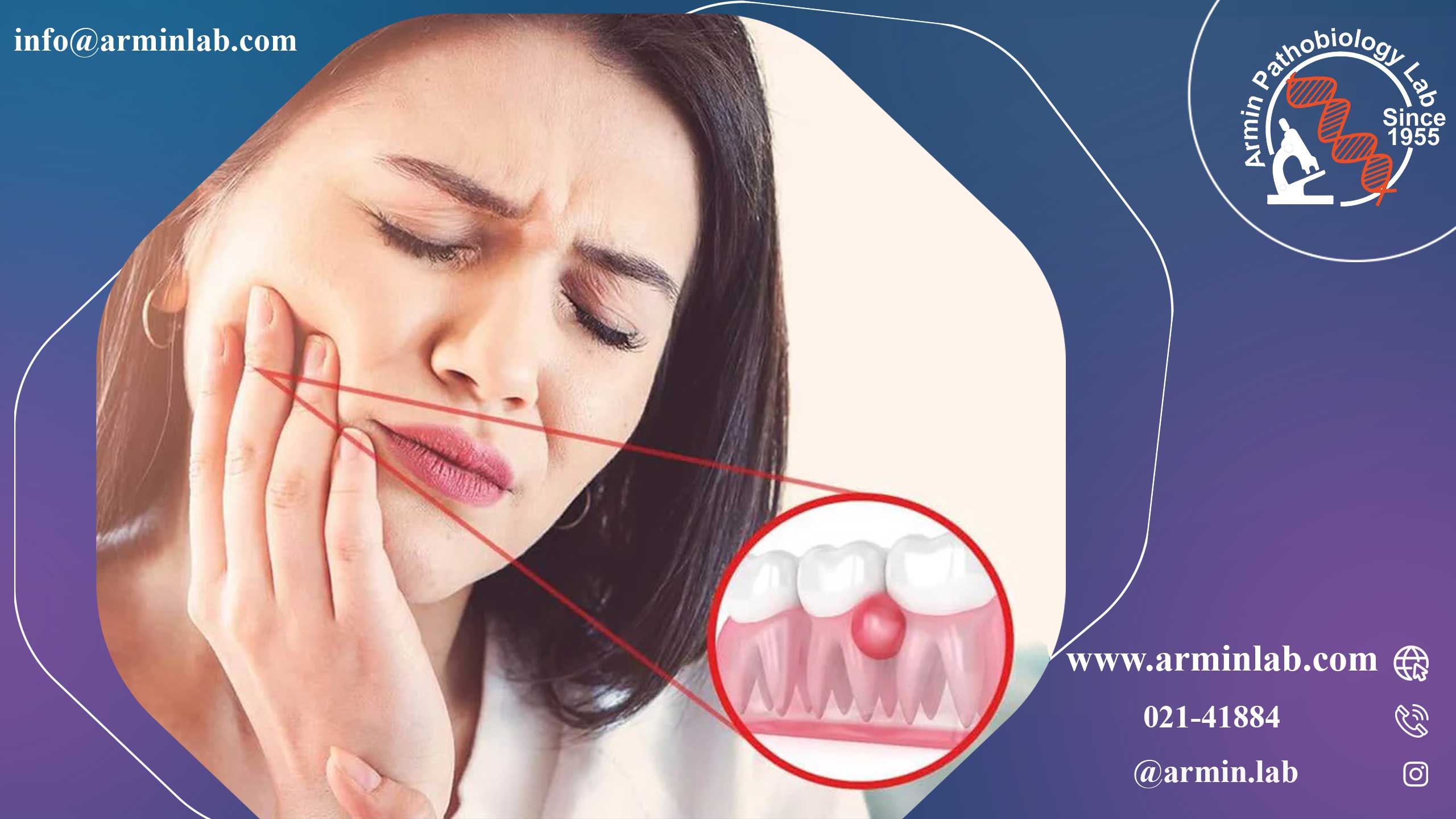 آبسه دندان در دوران بارداری