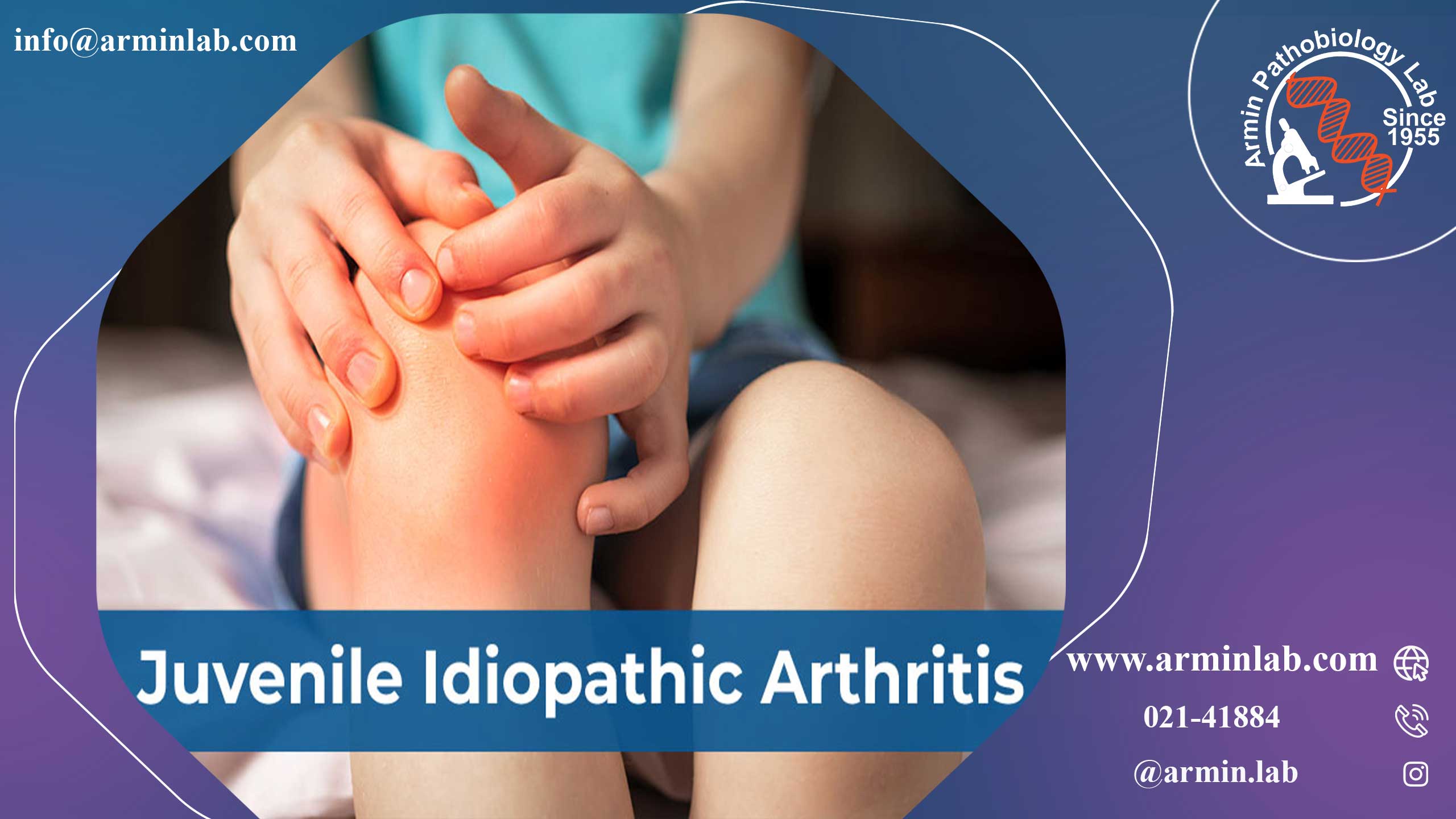 آرتریت ایدیوپاتیک نوجوانان (JIA)