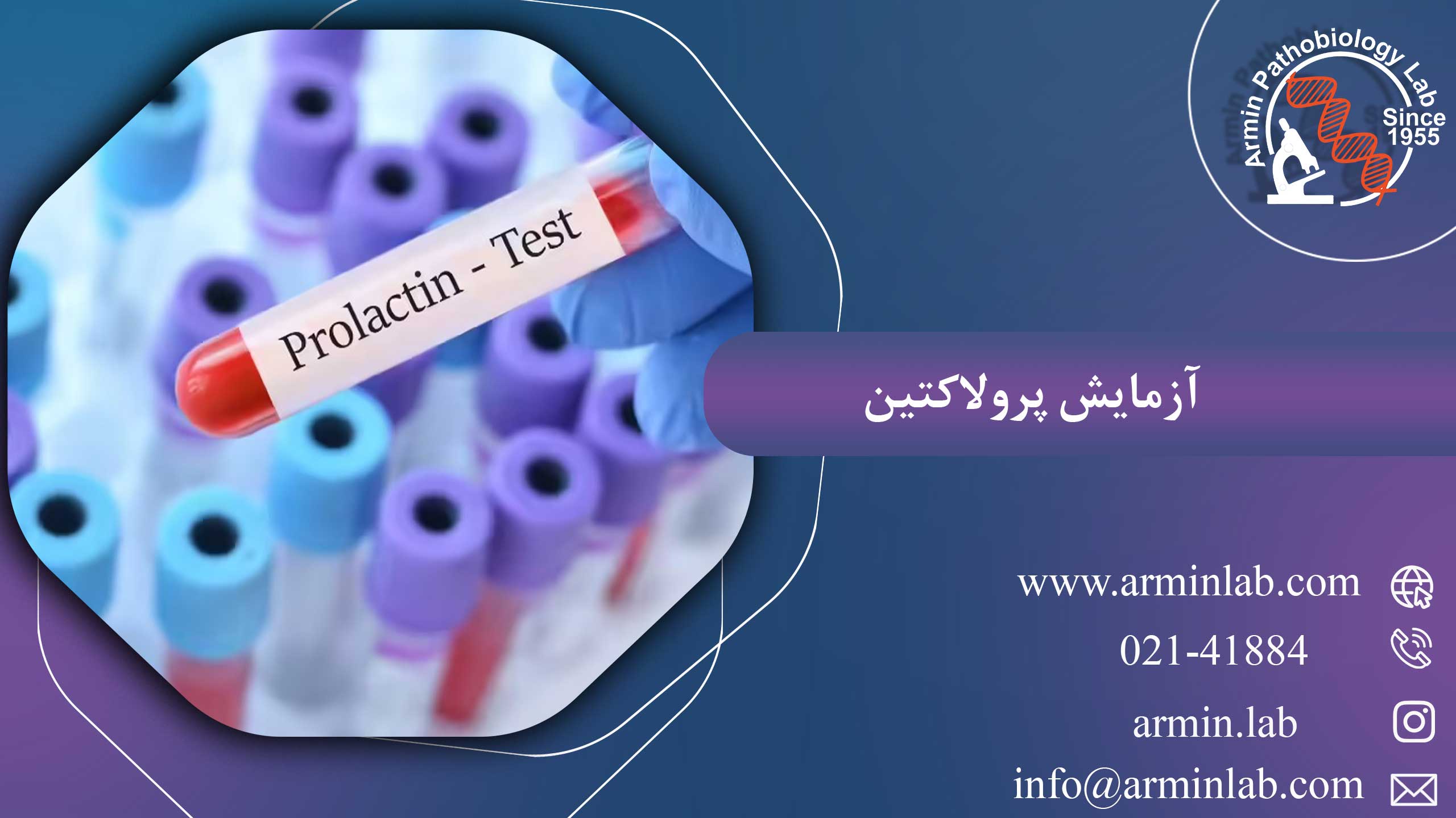 آزمایش پرولاکتین