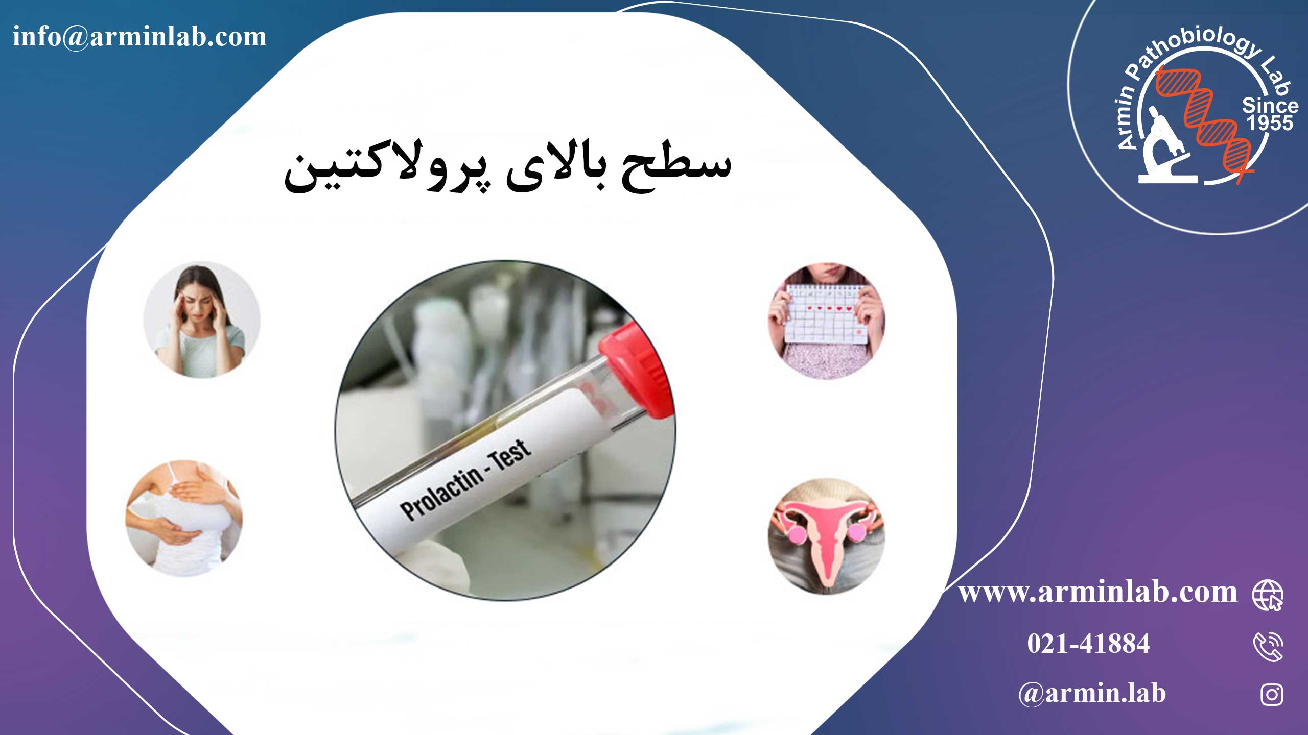 آزمایش پرولاکتین
