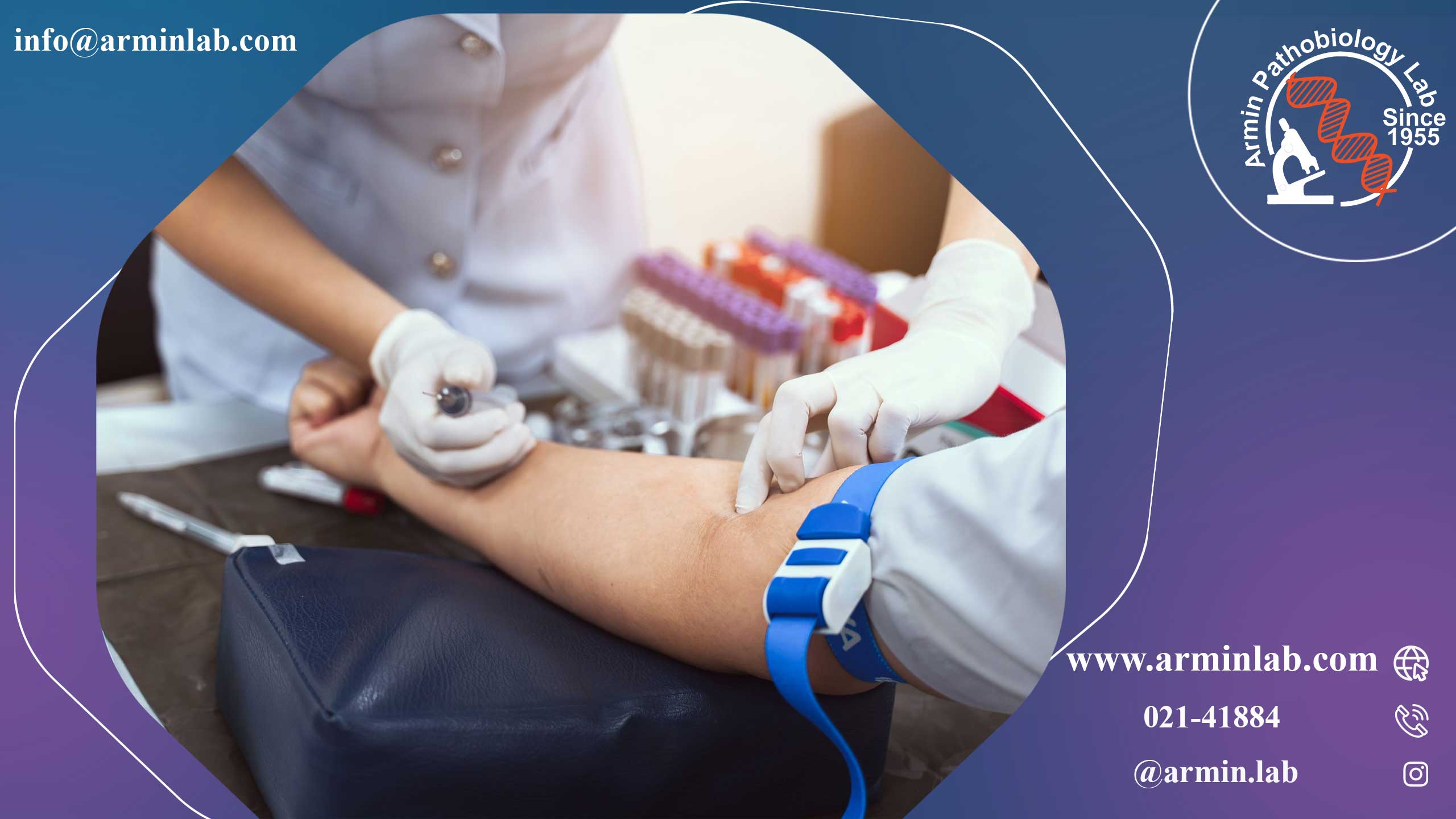 آزمایش پرولاکتین