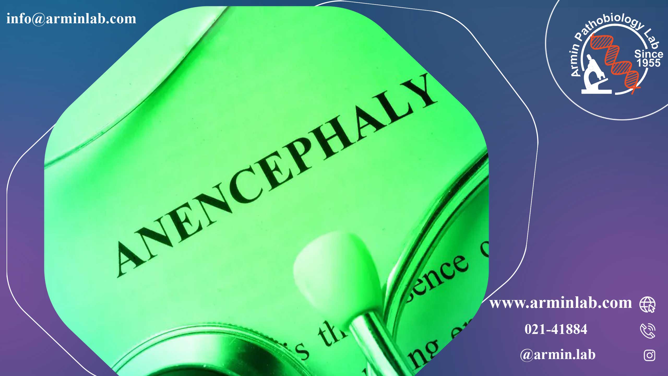 آنانسفالی  جنین