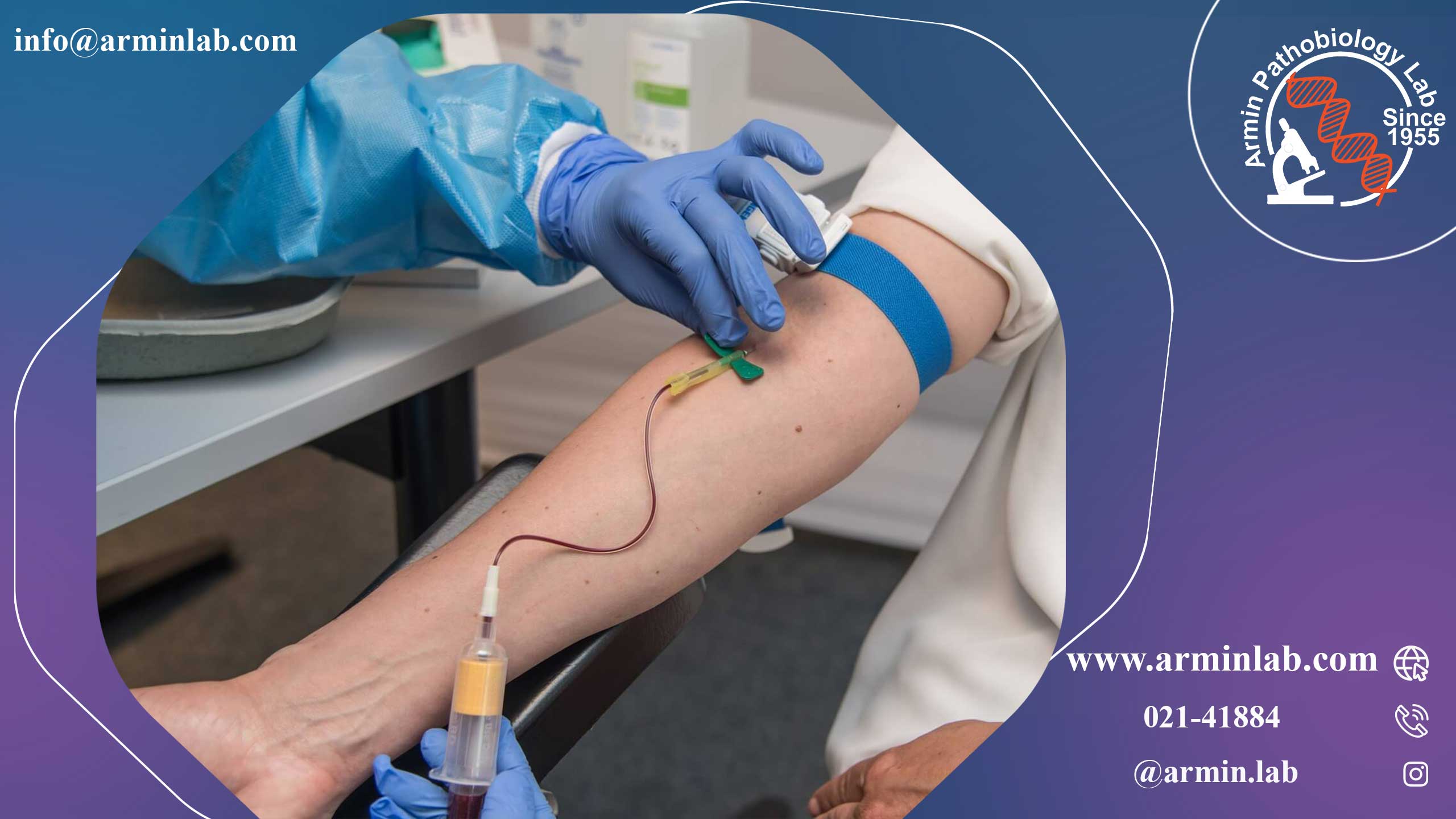 اسیدوز لاکتیک