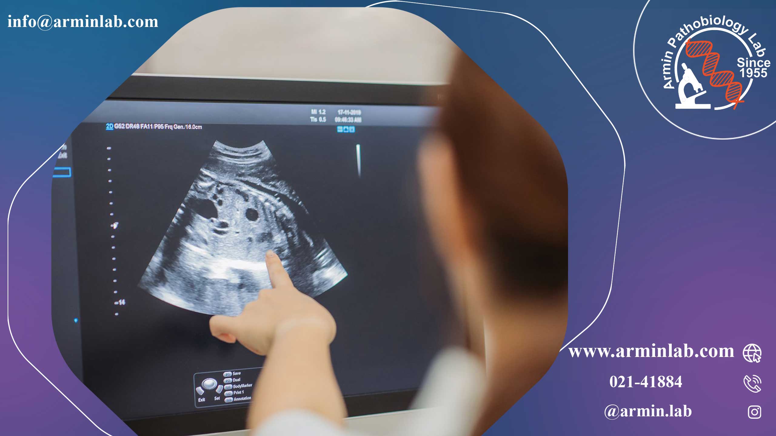 انواع سونوگرافی در دوران بارداری