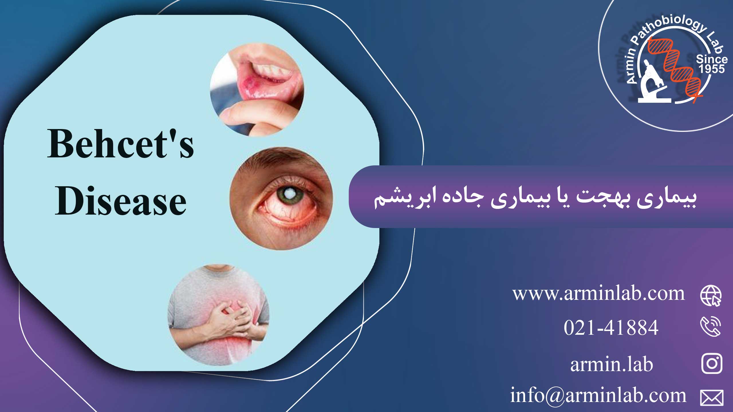 بیماری بهجت یا بیماری جاده ابریشم