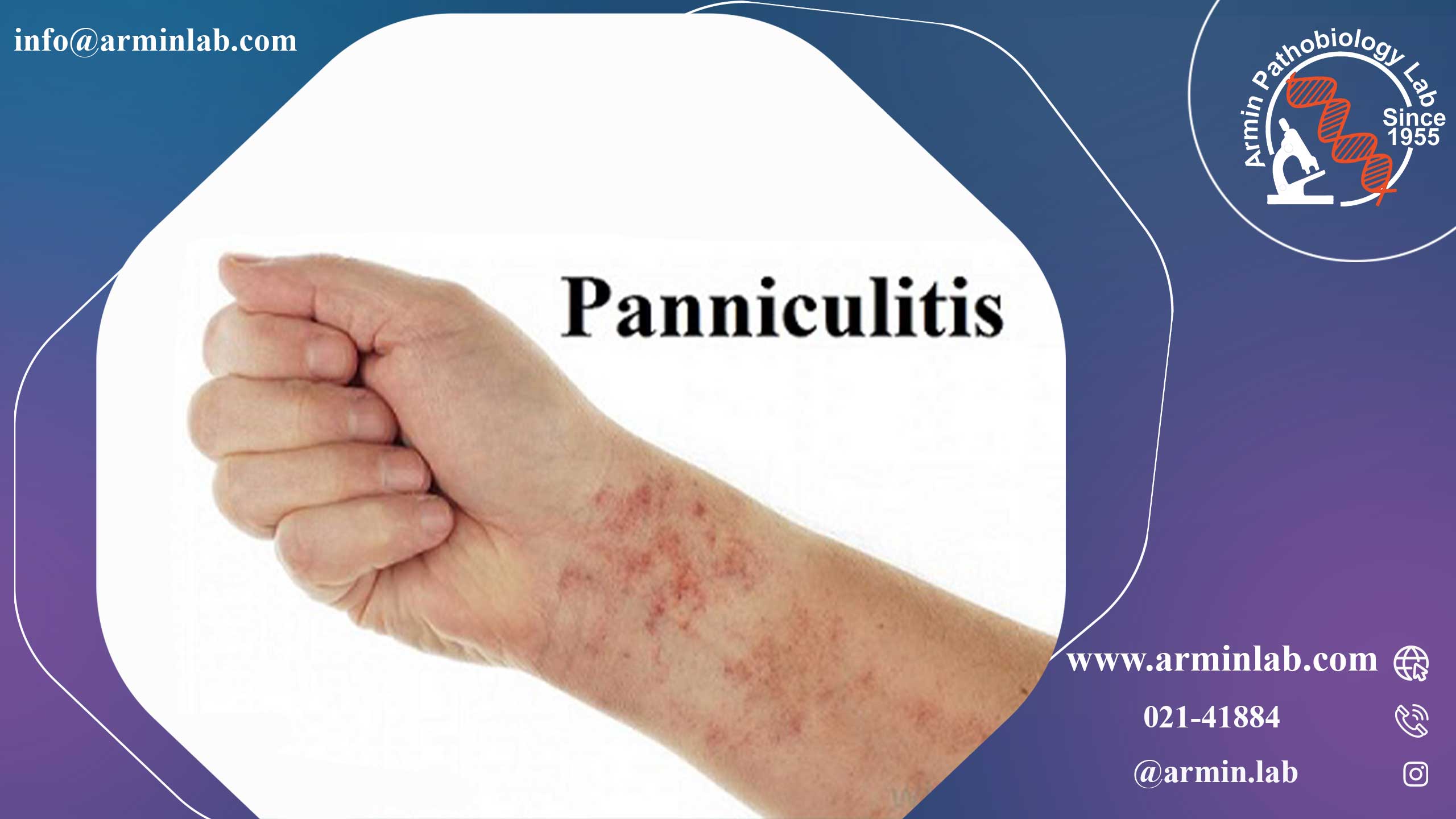 بیماری پانیکولیت 