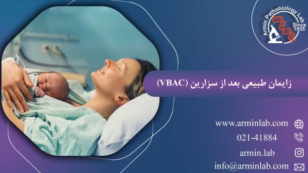 زایمان طبیعی بعد از سزارین (VBAC)