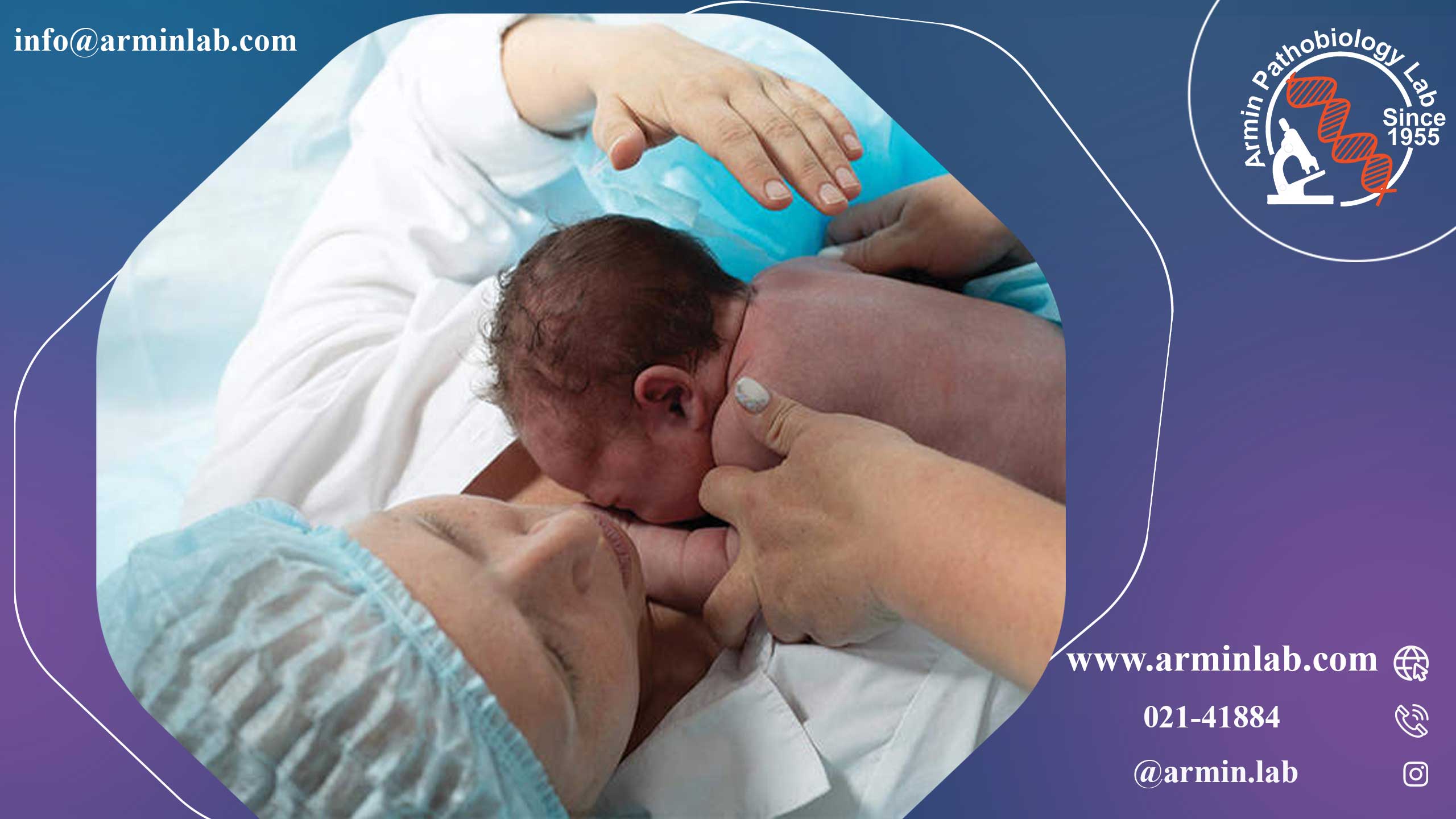 زایمان طبیعی بعد از سزارین (VBAC)