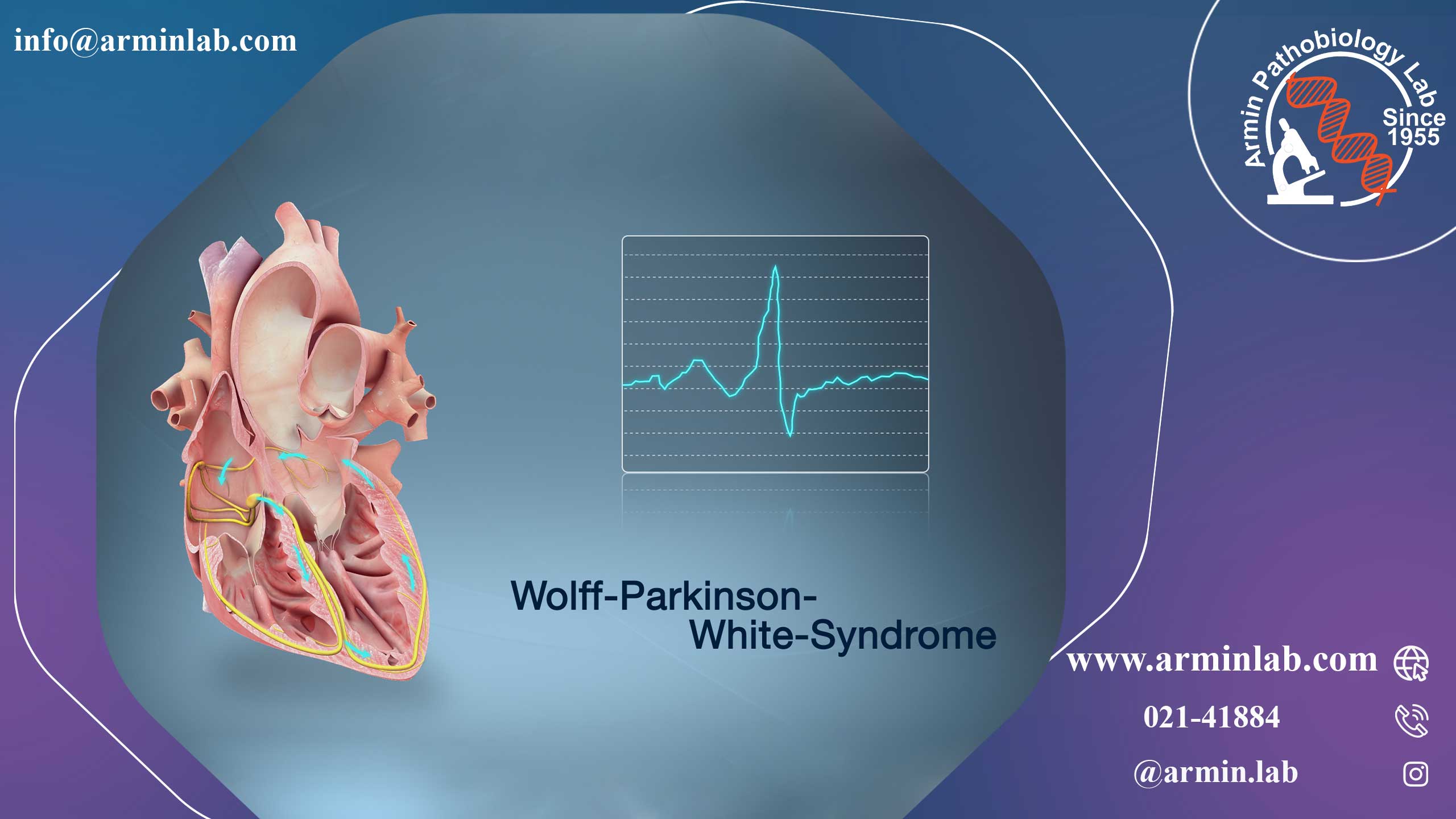 سندرم ولف-پارکینسون-وایت 