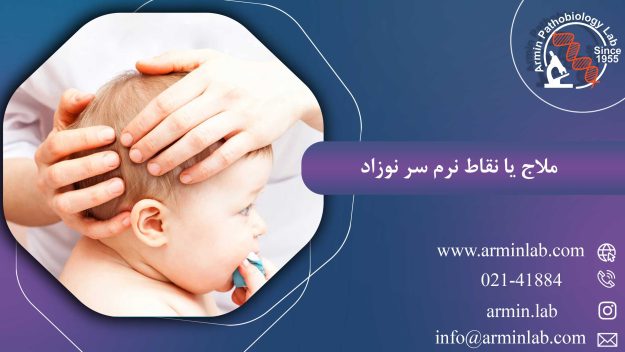 ملاج یا نقاط نرم سر نوزاد