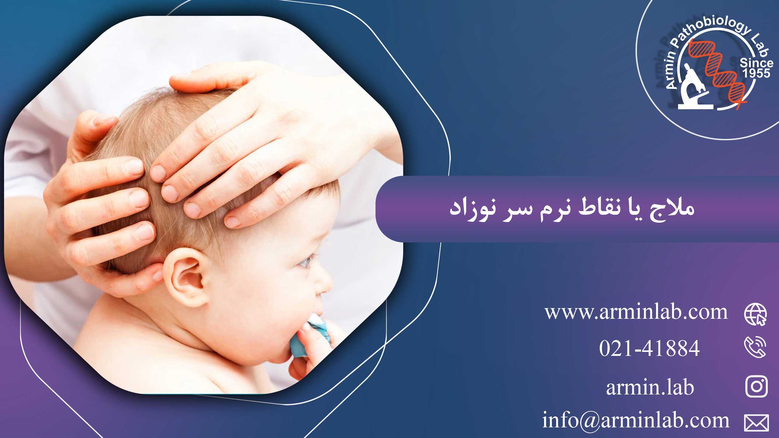 ملاج یا نقاط نرم سر نوزاد