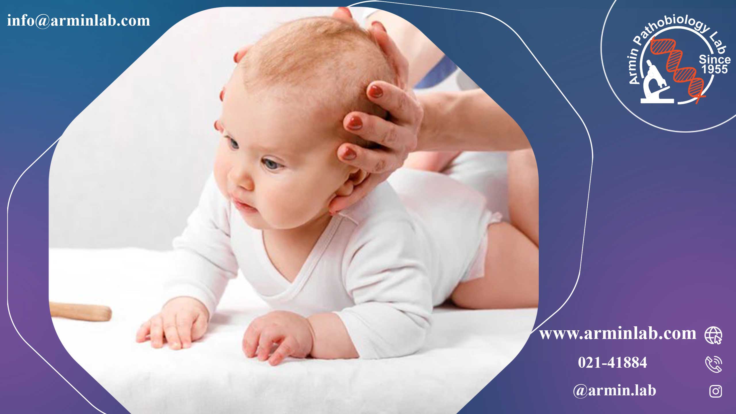 ملاج یا نقاط نرم سر نوزاد