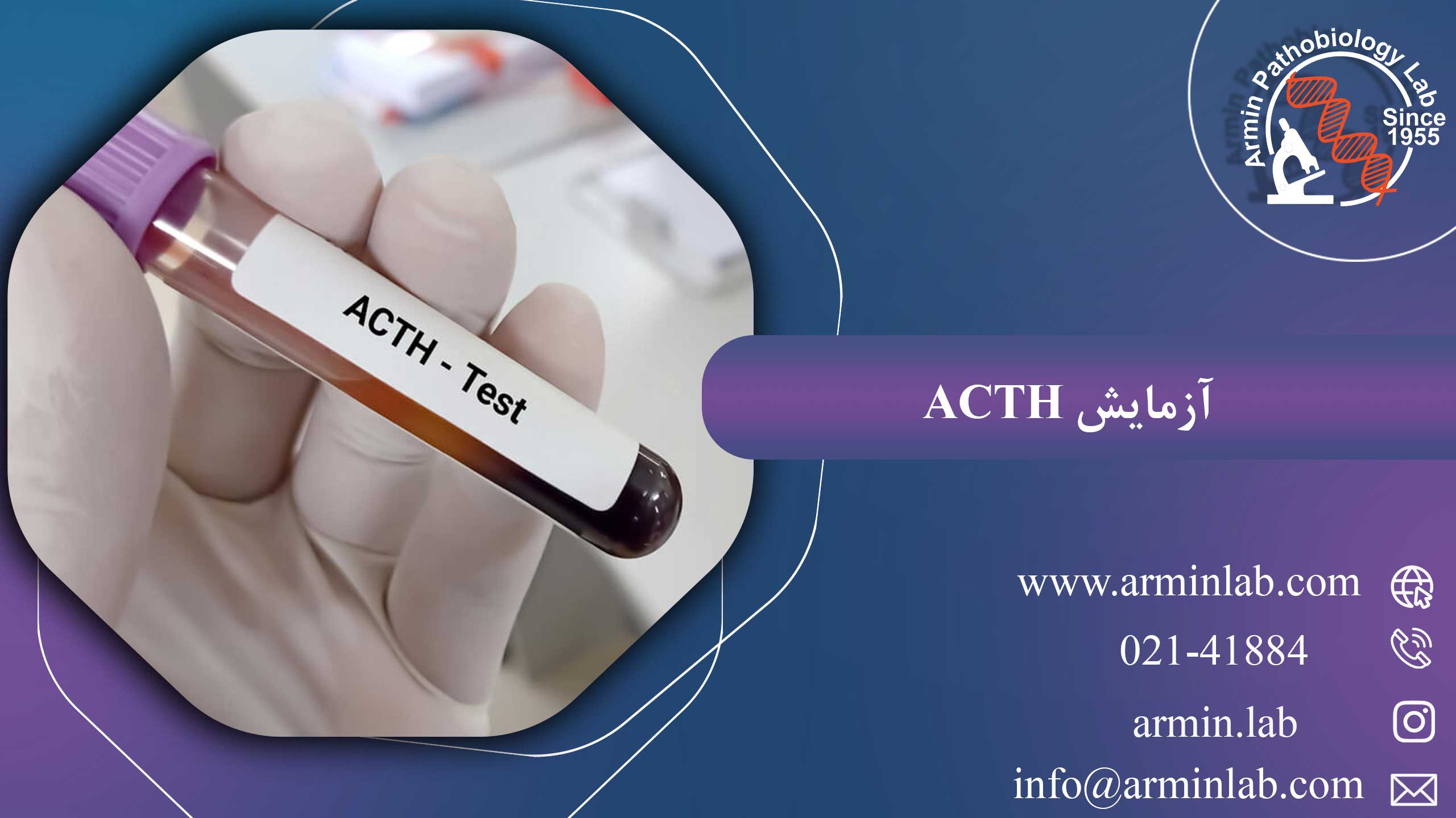 آزمایش-ACTH–arminlab1 آزمایش ACTH