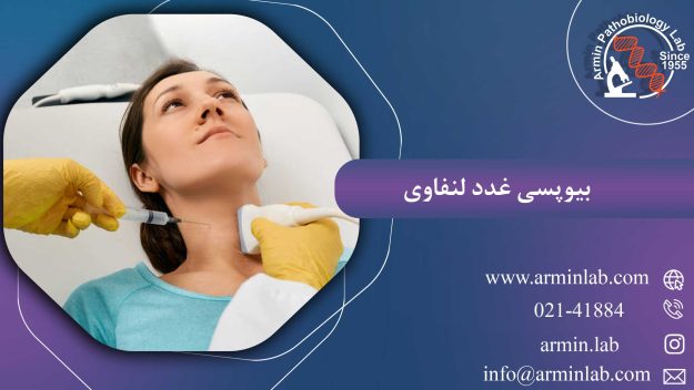 بیوپسی غدد لنفاوی