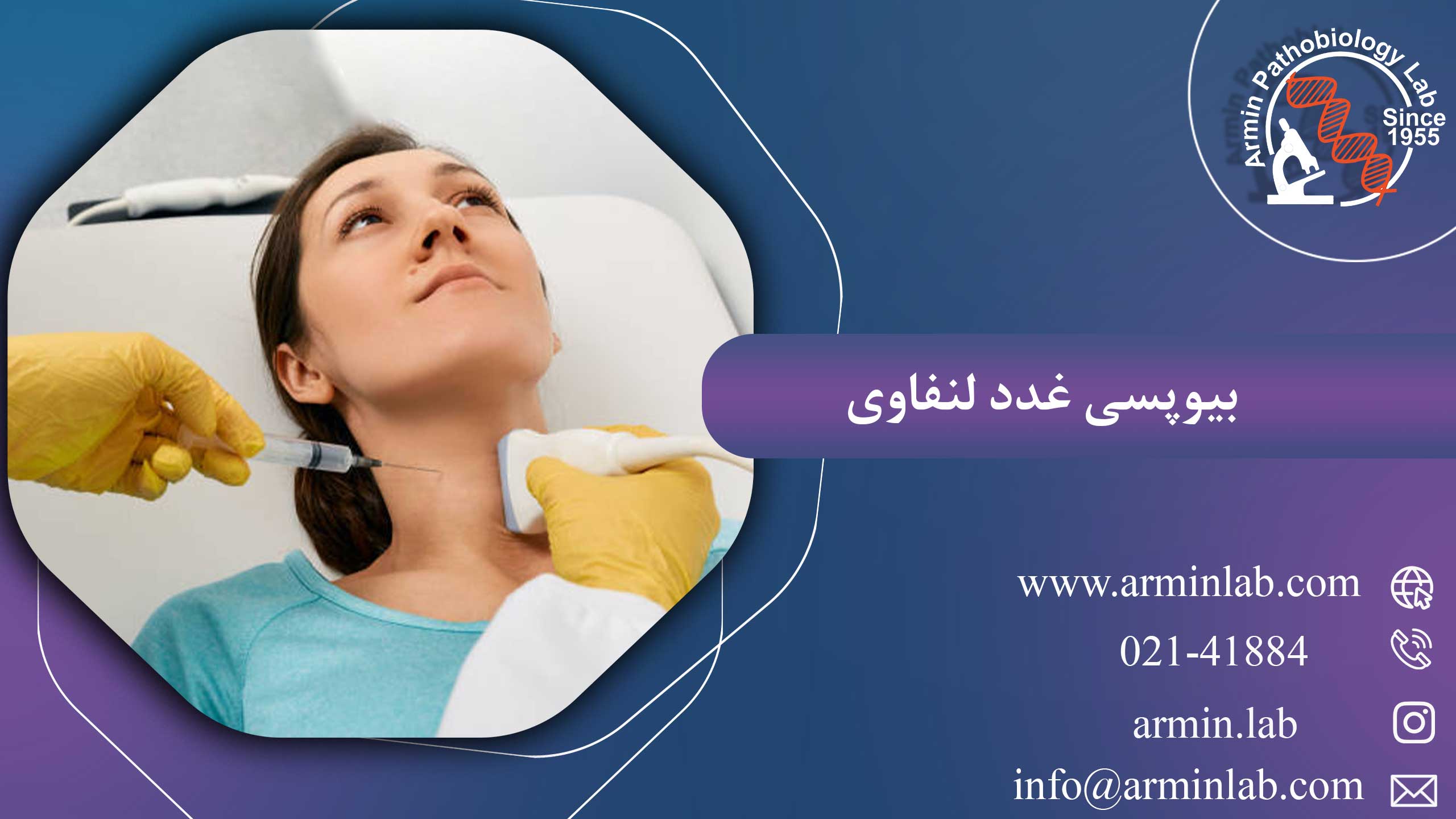 بیوپسی غدد لنفاوی
