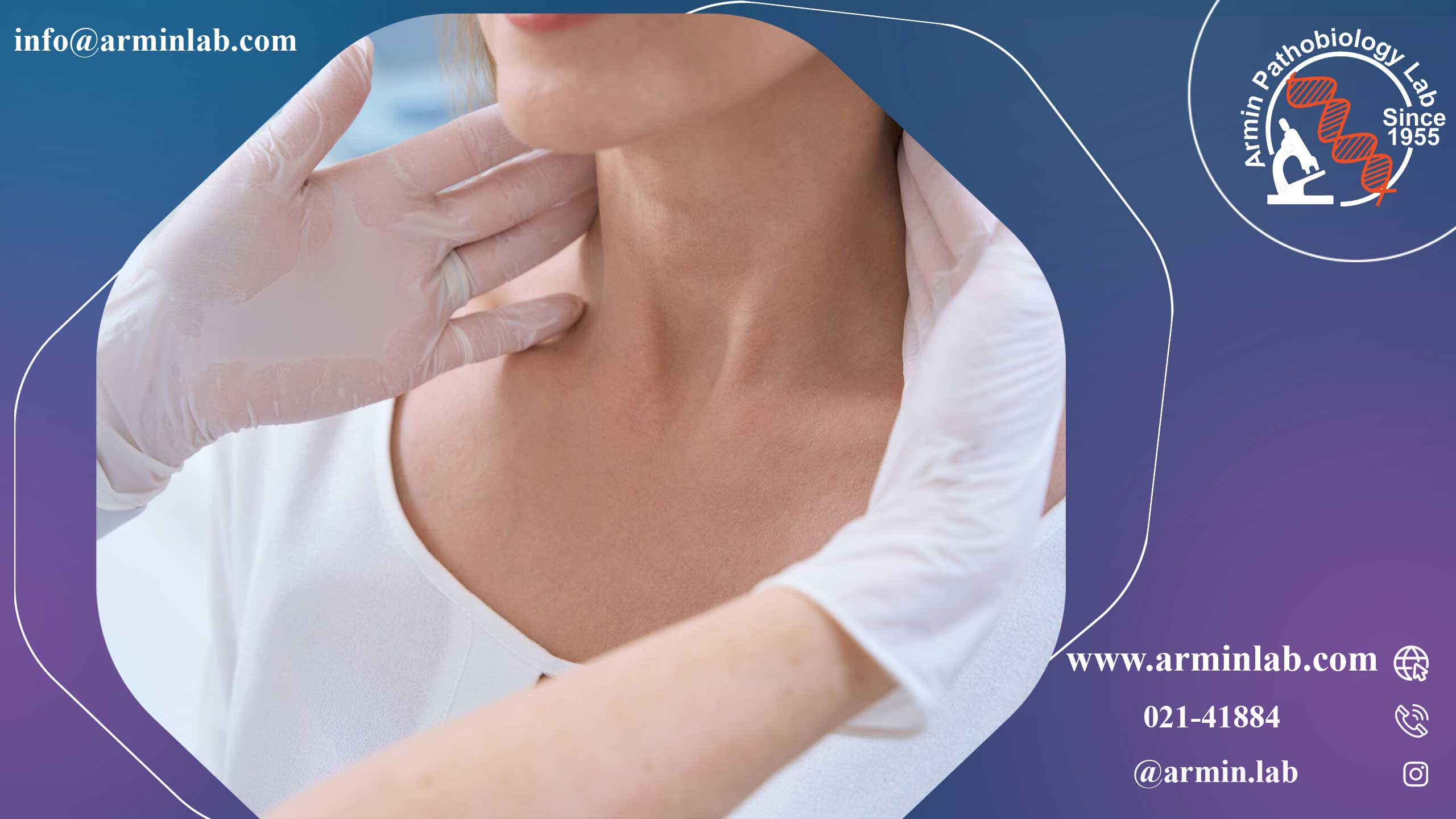 بیوپسی غدد لنفاوی