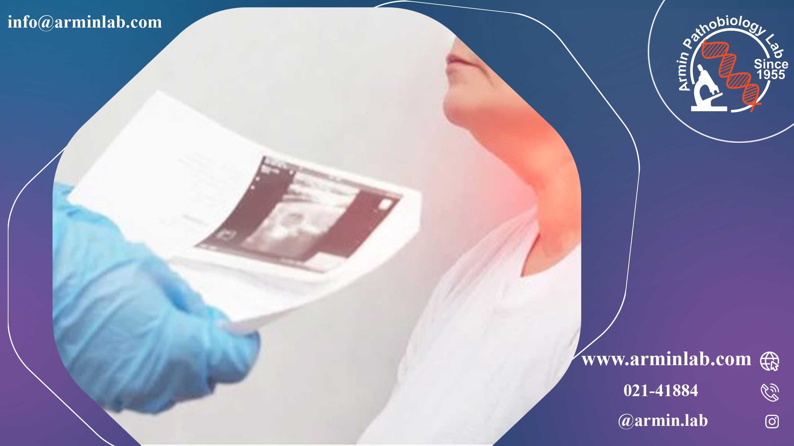 بیوپسی غدد لنفاوی